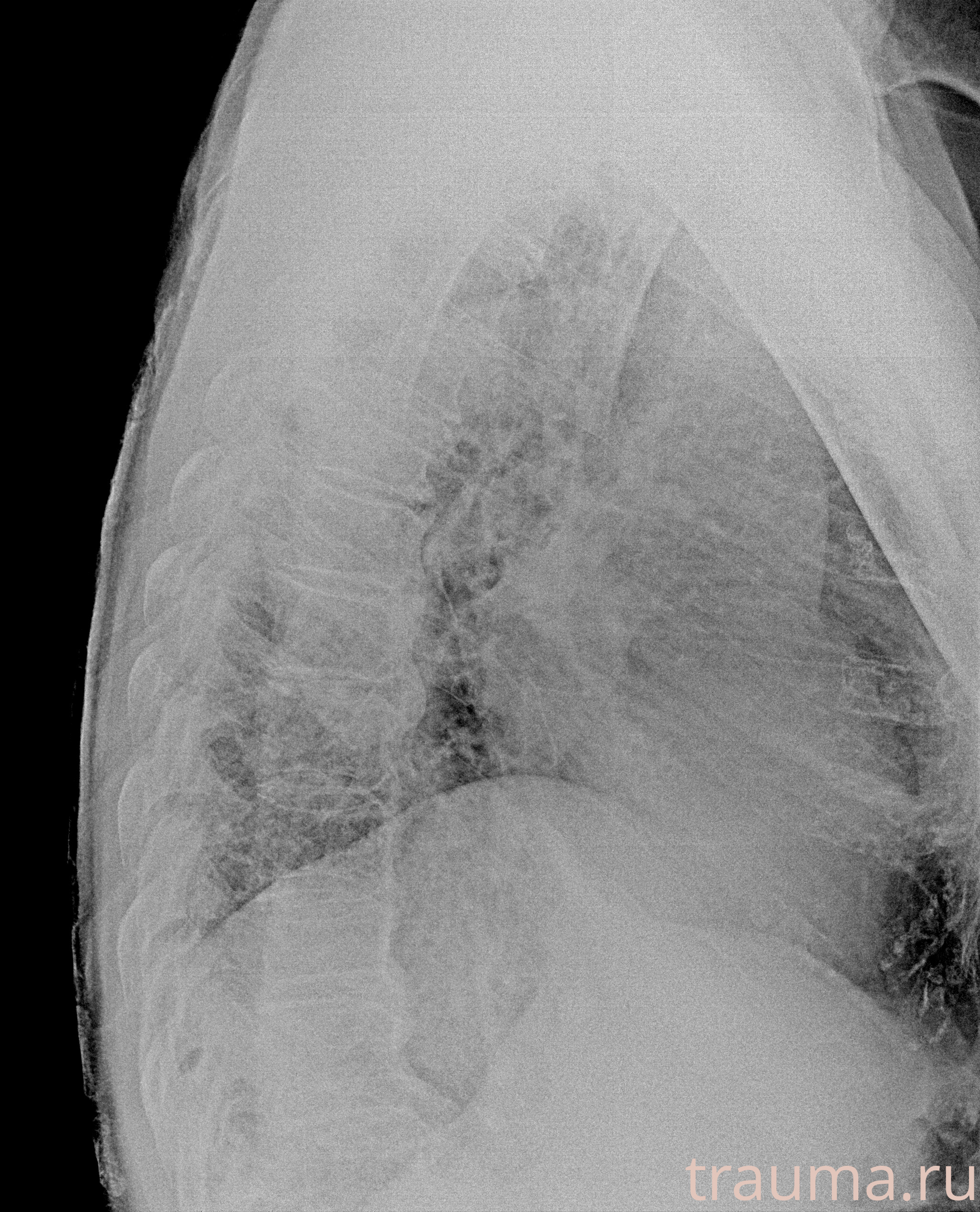 Рентген на дому: по вашему адресу приезжает врач-рентгенолог, травматолог-ортопед с мобильным рентгеновским аппаратом, проводит диагностику травмы или заболевания, делает необходимые рентгенограммы, дает рекомендации по дальнейшему лечению. Получить качественные снимки в домашних условиях возможно благодаря уникальной методике, разработанной МосРентген Центром для института  Склифосовского