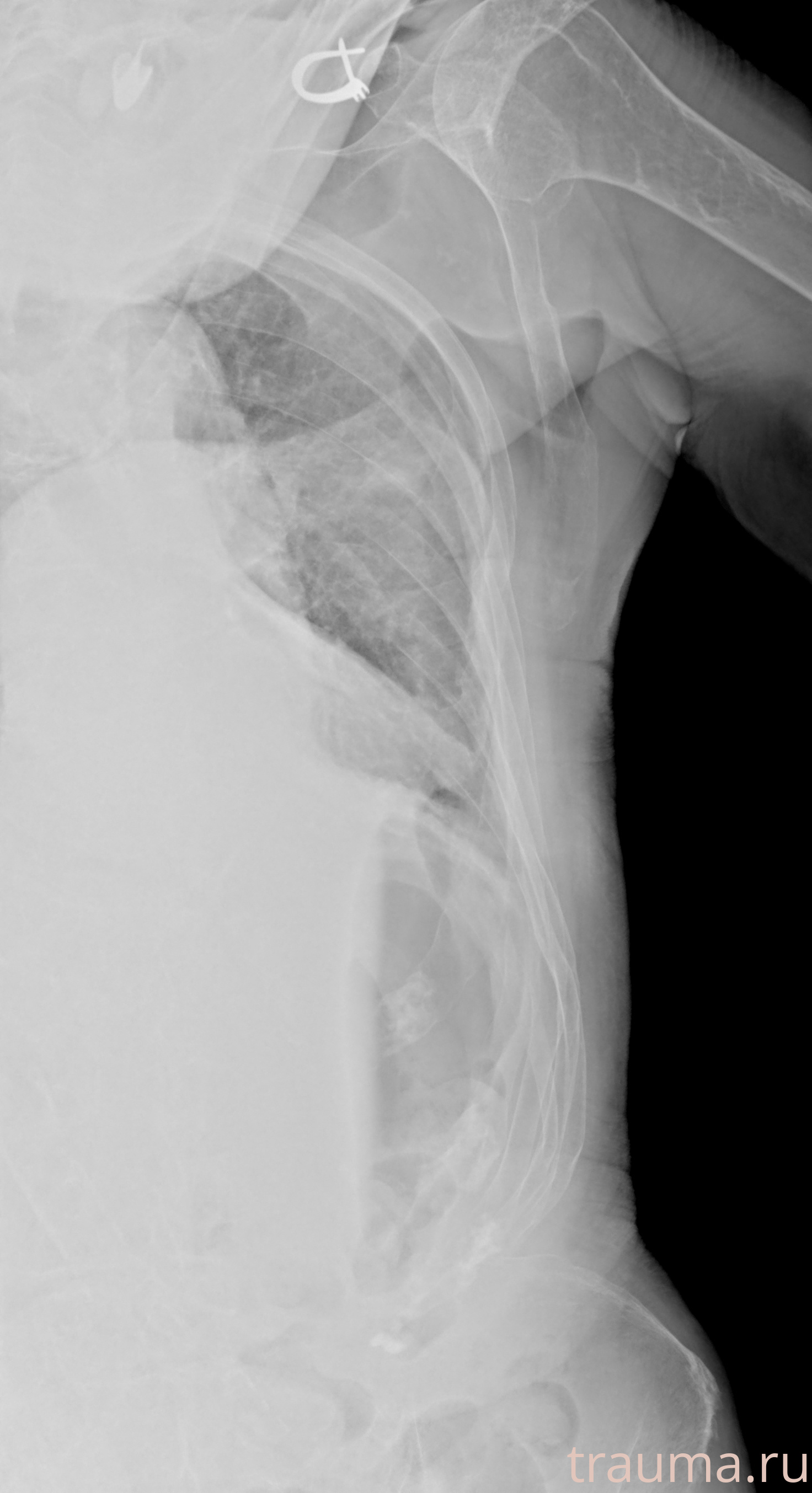 Рентген на дому: по вашему адресу приезжает врач-рентгенолог, травматолог-ортопед с мобильным рентгеновским аппаратом, проводит диагностику травмы или заболевания, делает необходимые рентгенограммы, дает рекомендации по дальнейшему лечению. Получить качественные снимки в домашних условиях возможно благодаря уникальной методике, разработанной МосРентген Центром для института  Склифосовского