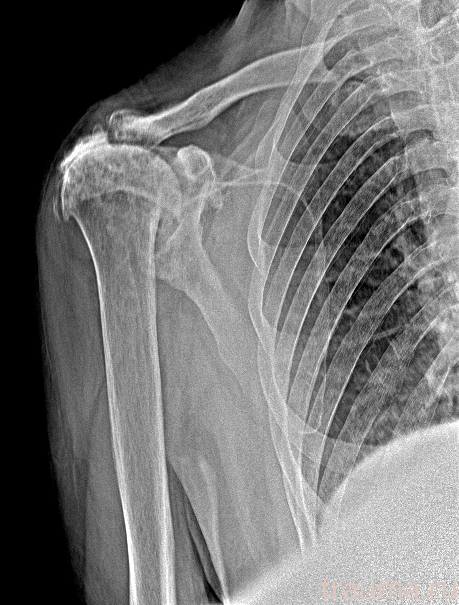 Рентген на дому: по вашему адресу приезжает врач-рентгенолог, травматолог-ортопед с мобильным рентгеновским аппаратом, проводит диагностику травмы или заболевания, делает необходимые рентгенограммы, дает рекомендации по дальнейшему лечению. Получить качественные снимки в домашних условиях возможно благодаря уникальной методике, разработанной МосРентген Центром для института  Склифосовского