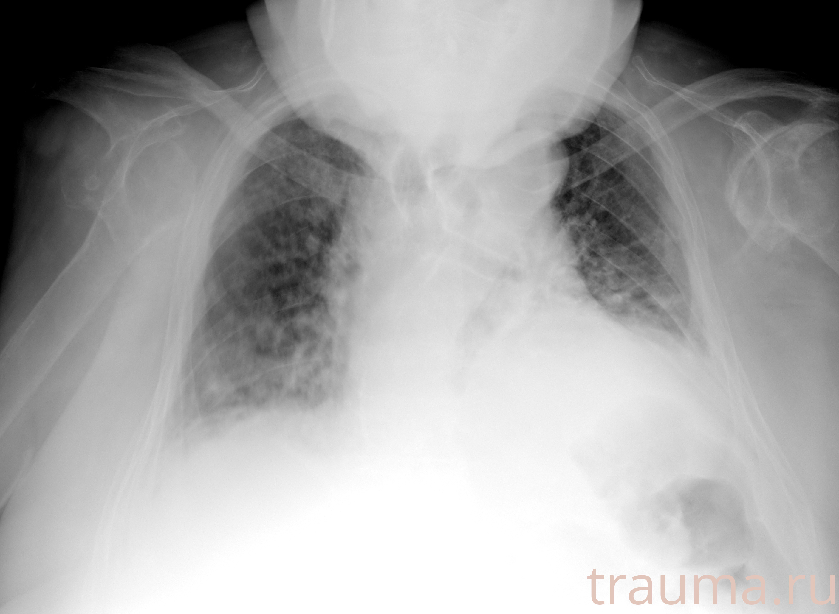 Рентген на дому: по вашему адресу приезжает врач-рентгенолог, травматолог-ортопед с мобильным рентгеновским аппаратом, проводит диагностику травмы или заболевания, делает необходимые рентгенограммы, дает рекомендации по дальнейшему лечению. Получить качественные снимки в домашних условиях возможно благодаря уникальной методике, разработанной МосРентген Центром для института  Склифосовского