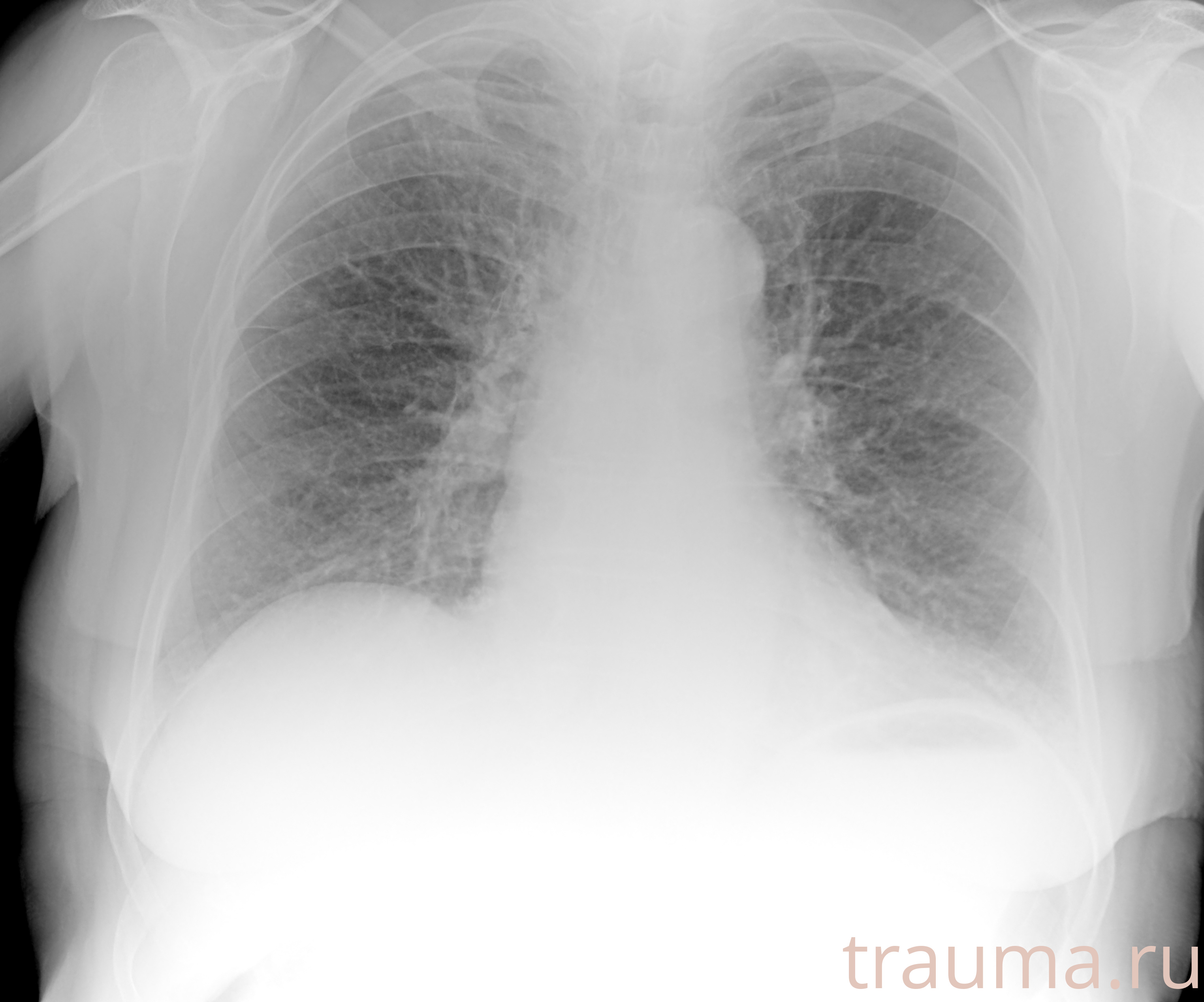 Рентген на дому: по вашему адресу приезжает врач-рентгенолог, травматолог-ортопед с мобильным рентгеновским аппаратом, проводит диагностику травмы или заболевания, делает необходимые рентгенограммы, дает рекомендации по дальнейшему лечению. Получить качественные снимки в домашних условиях возможно благодаря уникальной методике, разработанной МосРентген Центром для института  Склифосовского