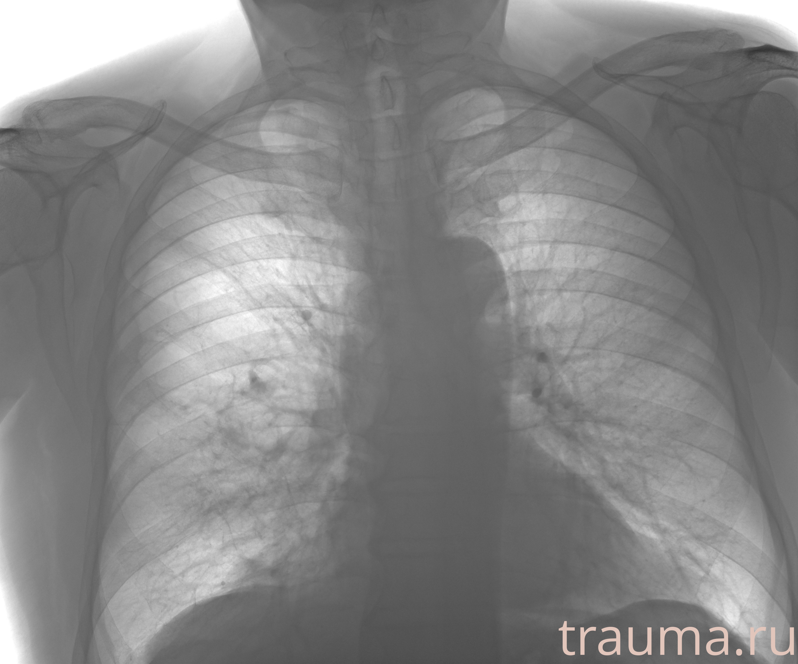 Рентген на дому: по вашему адресу приезжает врач-рентгенолог, травматолог-ортопед с мобильным рентгеновским аппаратом, проводит диагностику травмы или заболевания, делает необходимые рентгенограммы, дает рекомендации по дальнейшему лечению. Получить качественные снимки в домашних условиях возможно благодаря уникальной методике, разработанной МосРентген Центром для института  Склифосовского
