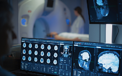 Почти половина сигналов МРТ оказалась не связана с реальной активностью мозга