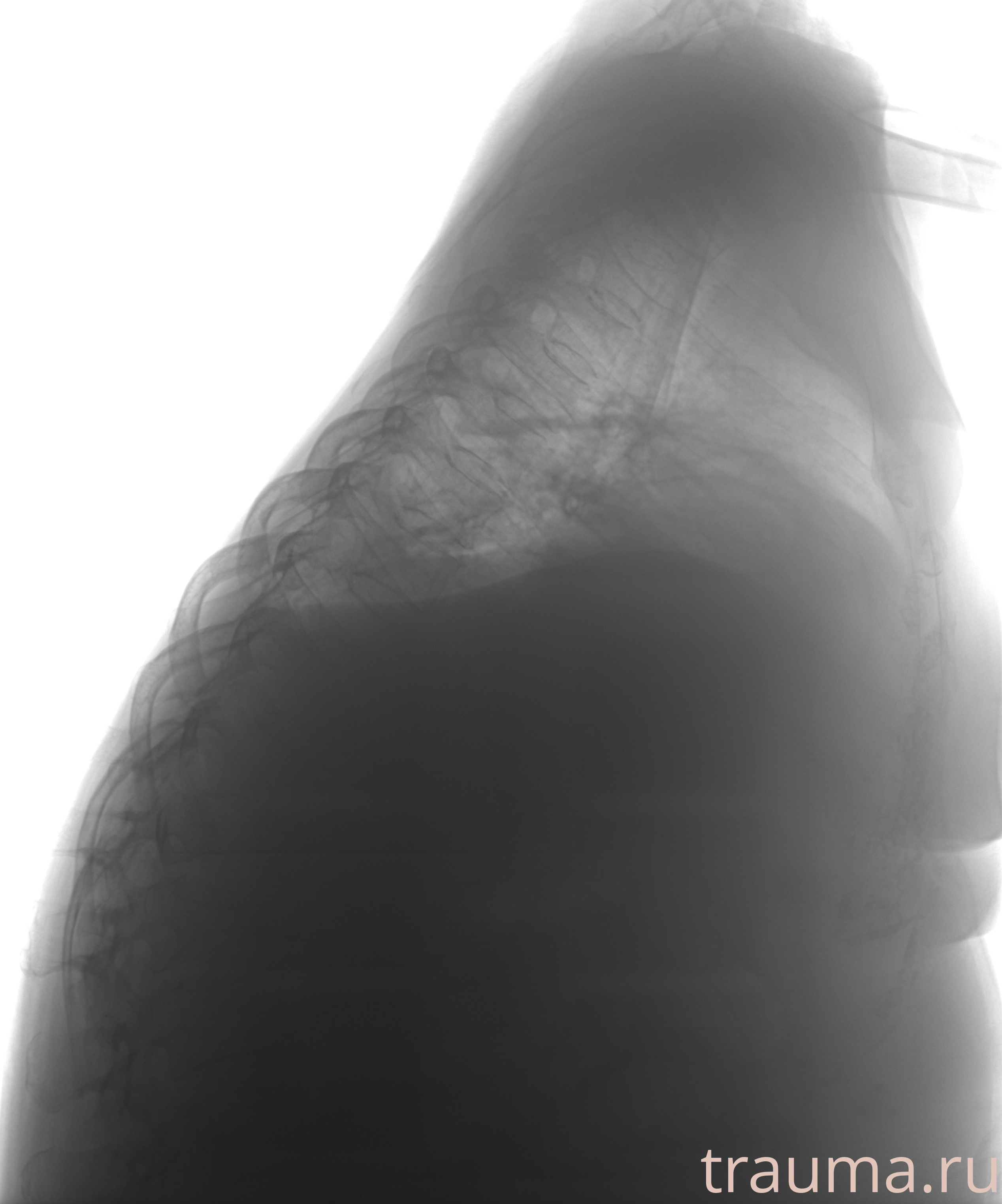 Рентген на дому: по вашему адресу приезжает врач-рентгенолог, травматолог-ортопед с мобильным рентгеновским аппаратом, проводит диагностику травмы или заболевания, делает необходимые рентгенограммы, дает рекомендации по дальнейшему лечению. Получить качественные снимки в домашних условиях возможно благодаря уникальной методике, разработанной МосРентген Центром для института  Склифосовского