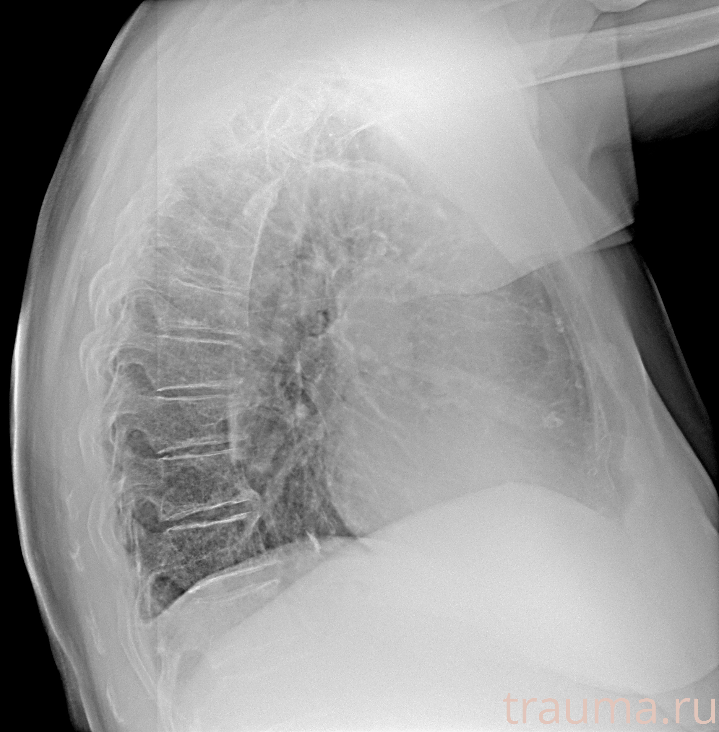 Рентген на дому: по вашему адресу приезжает врач-рентгенолог, травматолог-ортопед с мобильным рентгеновским аппаратом, проводит диагностику травмы или заболевания, делает необходимые рентгенограммы, дает рекомендации по дальнейшему лечению. Получить качественные снимки в домашних условиях возможно благодаря уникальной методике, разработанной МосРентген Центром для института  Склифосовского