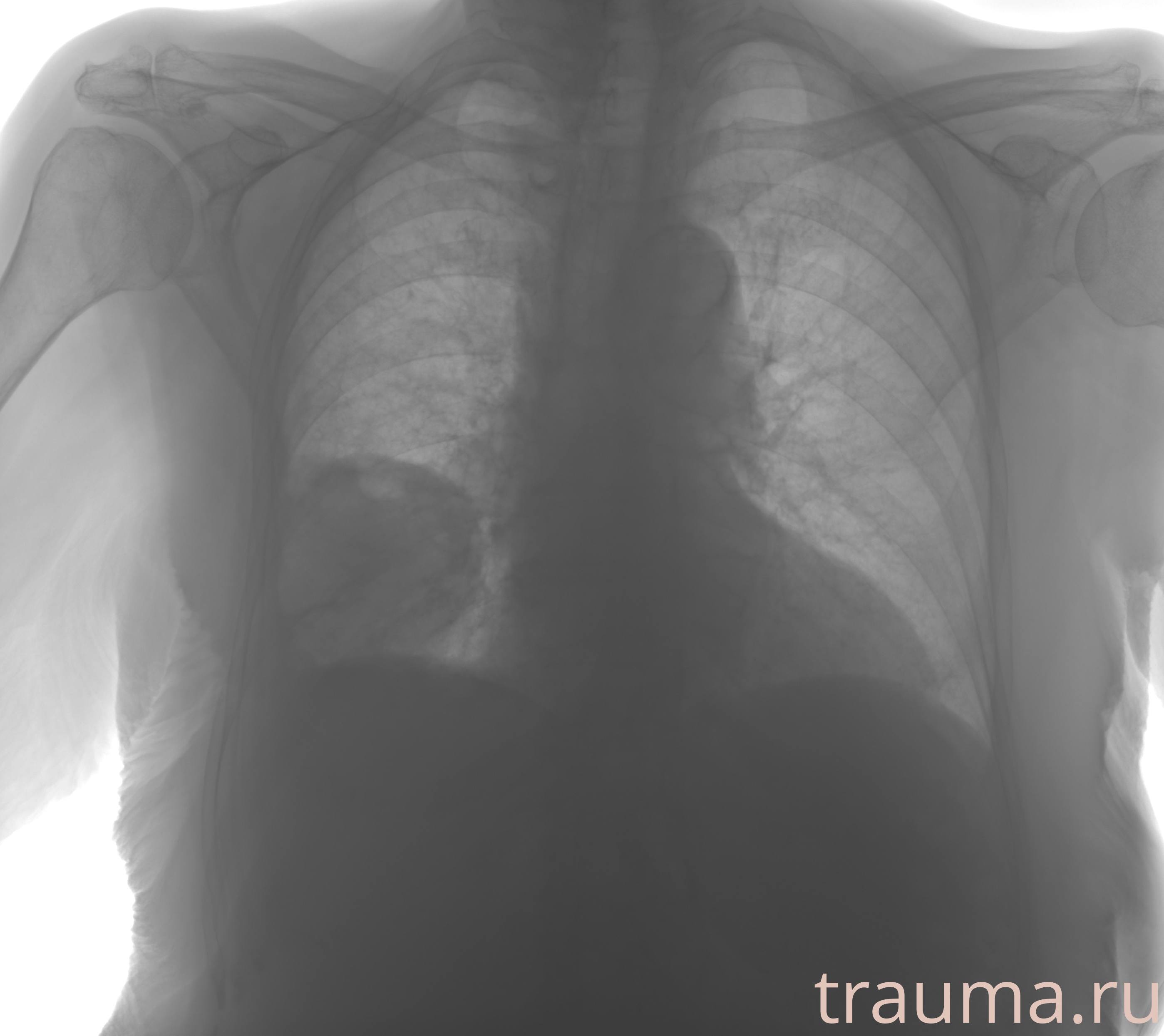 Рентген на дому: по вашему адресу приезжает врач-рентгенолог, травматолог-ортопед с мобильным рентгеновским аппаратом, проводит диагностику травмы или заболевания, делает необходимые рентгенограммы, дает рекомендации по дальнейшему лечению. Получить качественные снимки в домашних условиях возможно благодаря уникальной методике, разработанной МосРентген Центром для института  Склифосовского