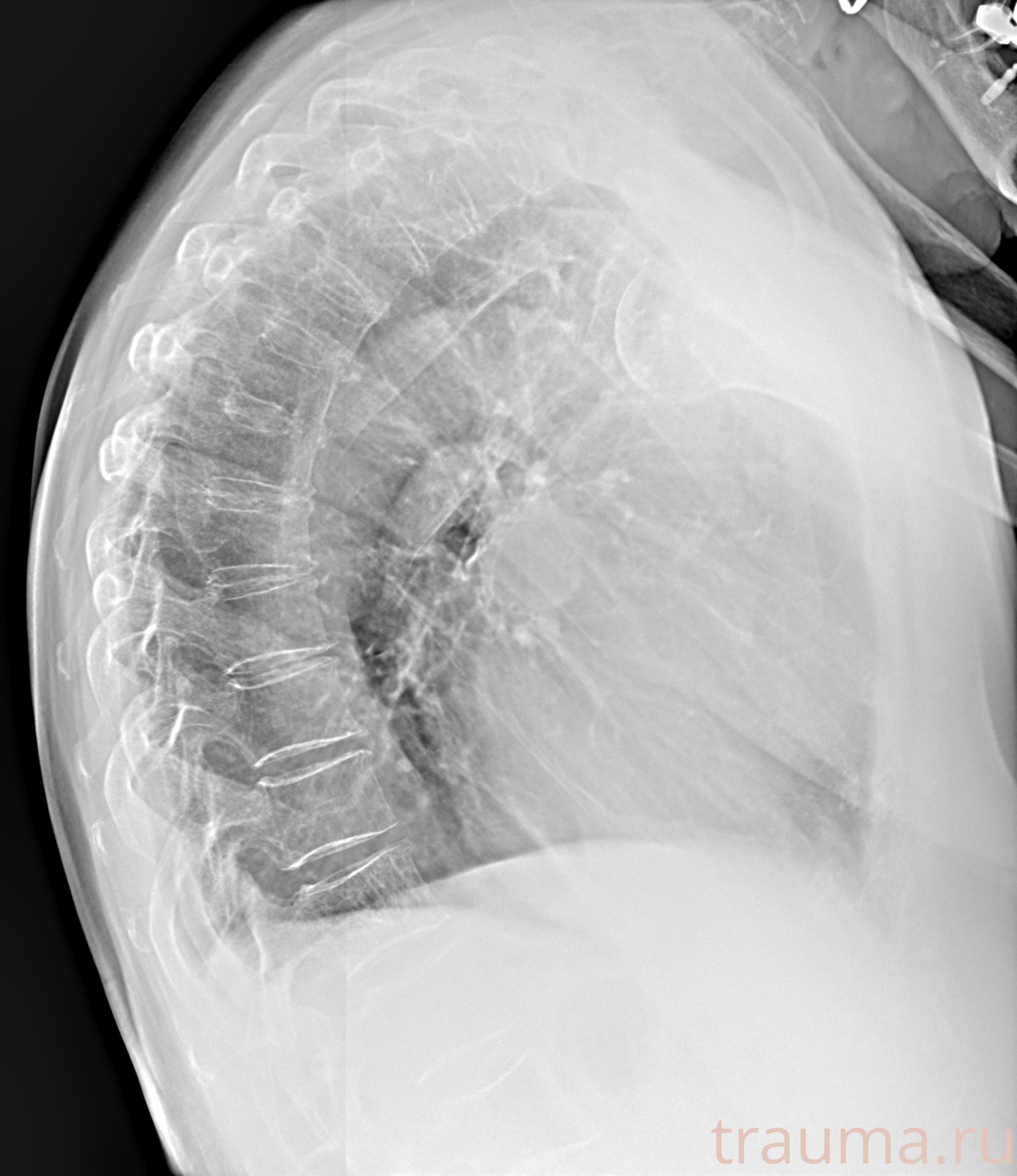 Рентген на дому: по вашему адресу приезжает врач-рентгенолог, травматолог-ортопед с мобильным рентгеновским аппаратом, проводит диагностику травмы или заболевания, делает необходимые рентгенограммы, дает рекомендации по дальнейшему лечению. Получить качественные снимки в домашних условиях возможно благодаря уникальной методике, разработанной МосРентген Центром для института  Склифосовского