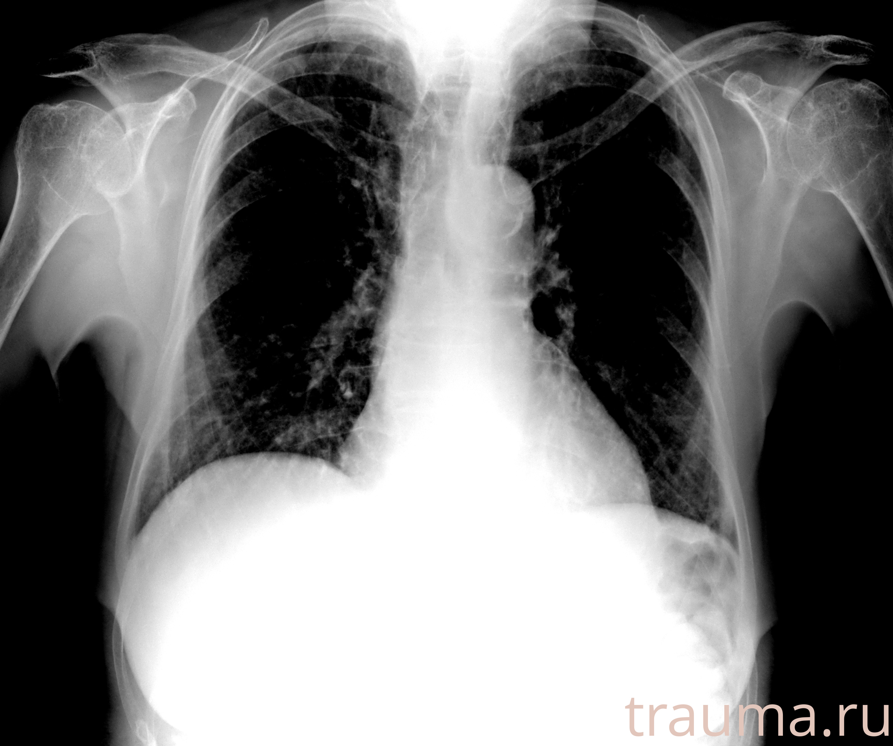 Рентген на дому: по вашему адресу приезжает врач-рентгенолог, травматолог-ортопед с мобильным рентгеновским аппаратом, проводит диагностику травмы или заболевания, делает необходимые рентгенограммы, дает рекомендации по дальнейшему лечению. Получить качественные снимки в домашних условиях возможно благодаря уникальной методике, разработанной МосРентген Центром для института  Склифосовского