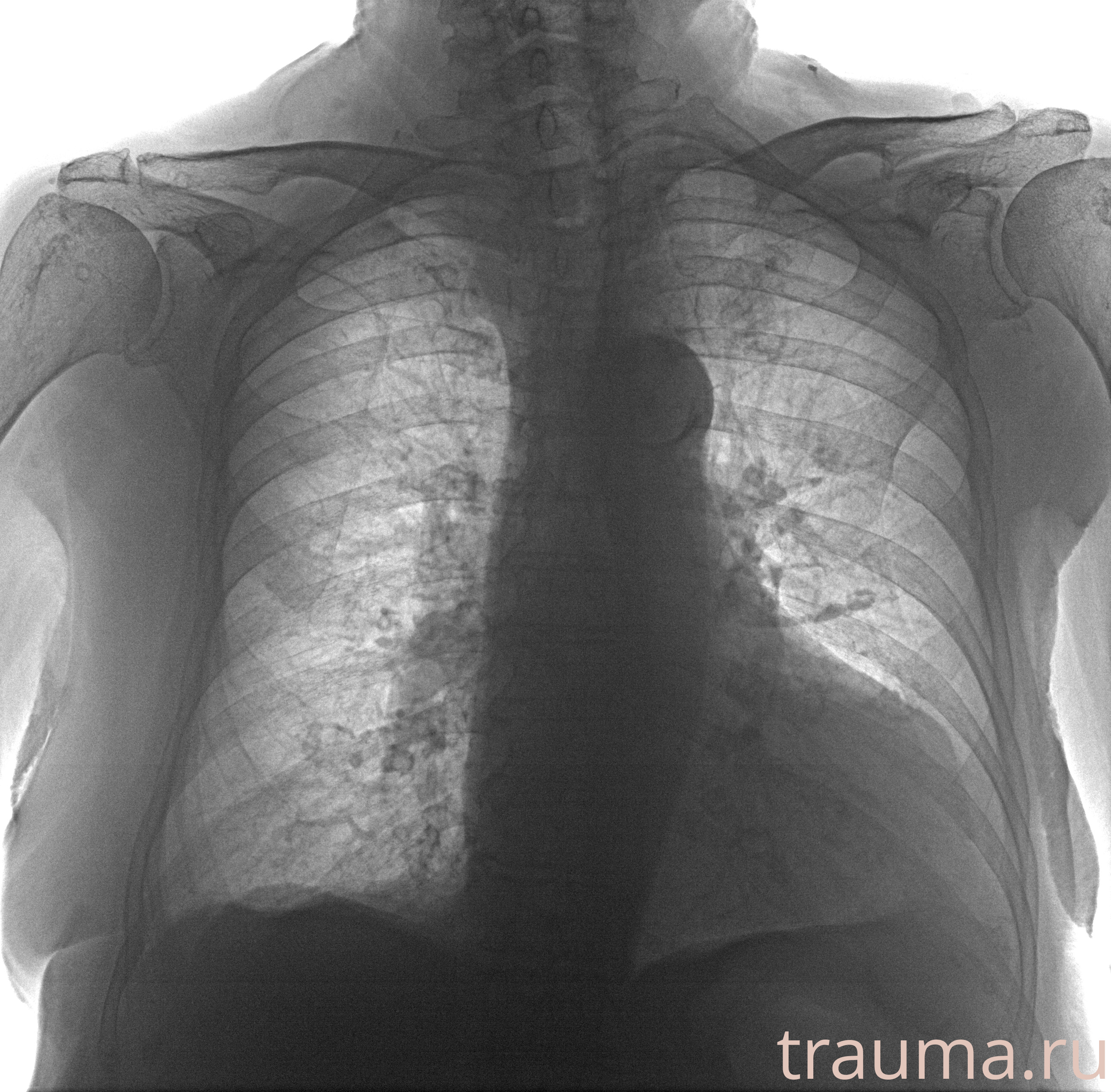 Рентген на дому: по вашему адресу приезжает врач-рентгенолог, травматолог-ортопед с мобильным рентгеновским аппаратом, проводит диагностику травмы или заболевания, делает необходимые рентгенограммы, дает рекомендации по дальнейшему лечению. Получить качественные снимки в домашних условиях возможно благодаря уникальной методике, разработанной МосРентген Центром для института  Склифосовского