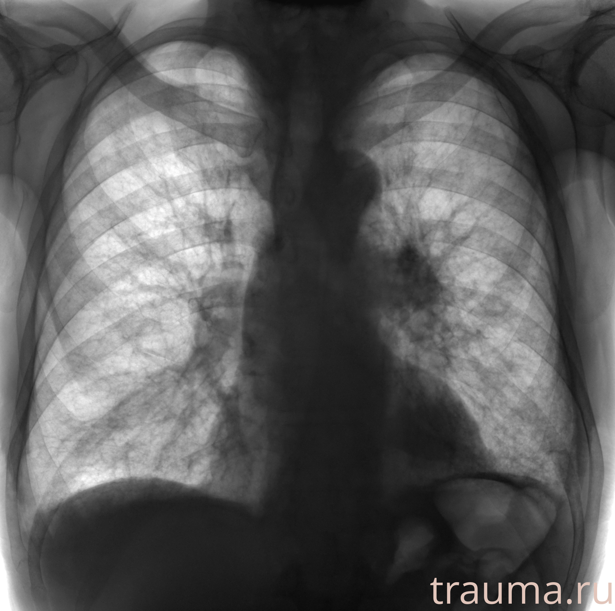 Рентген на дому: по вашему адресу приезжает врач-рентгенолог, травматолог-ортопед с мобильным рентгеновским аппаратом, проводит диагностику травмы или заболевания, делает необходимые рентгенограммы, дает рекомендации по дальнейшему лечению. Получить качественные снимки в домашних условиях возможно благодаря уникальной методике, разработанной МосРентген Центром для института  Склифосовского