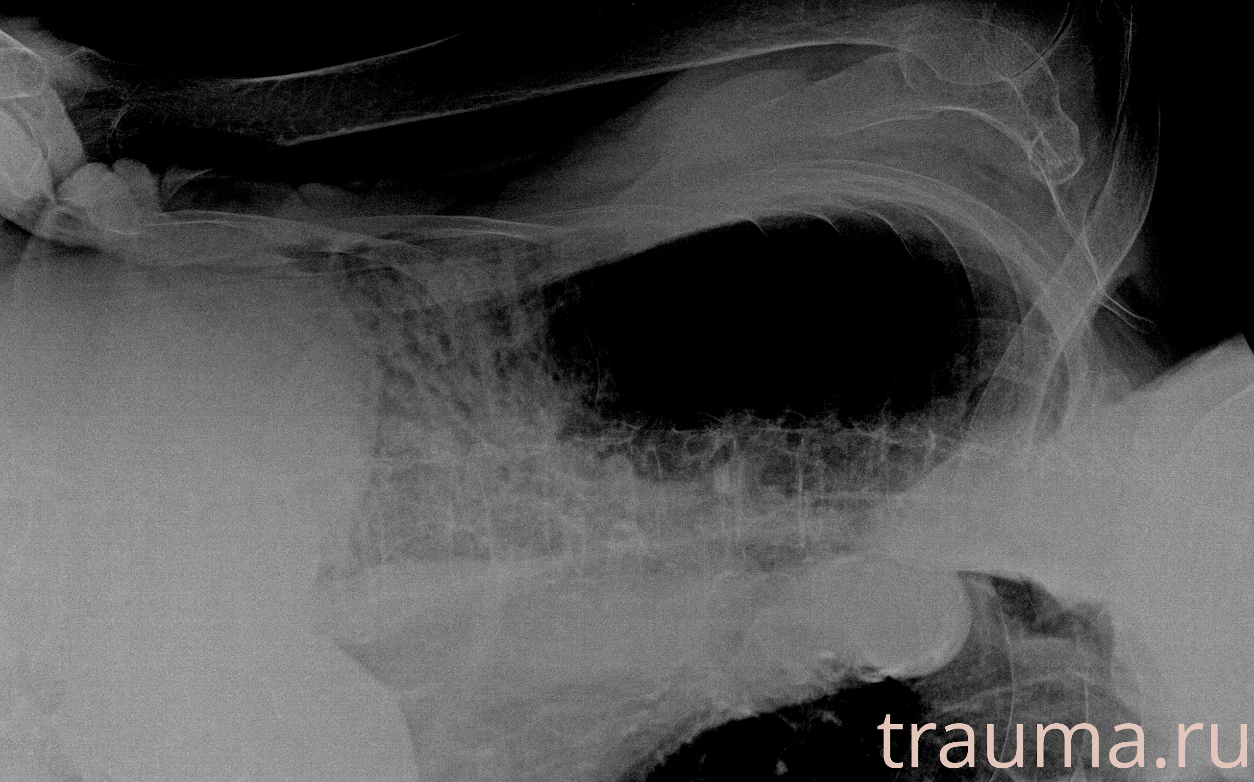 Рентген на дому: по вашему адресу приезжает врач-рентгенолог, травматолог-ортопед с мобильным рентгеновским аппаратом, проводит диагностику травмы или заболевания, делает необходимые рентгенограммы, дает рекомендации по дальнейшему лечению. Получить качественные снимки в домашних условиях возможно благодаря уникальной методике, разработанной МосРентген Центром для института  Склифосовского
