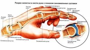 Заболевания кисти Заболевания кисти
