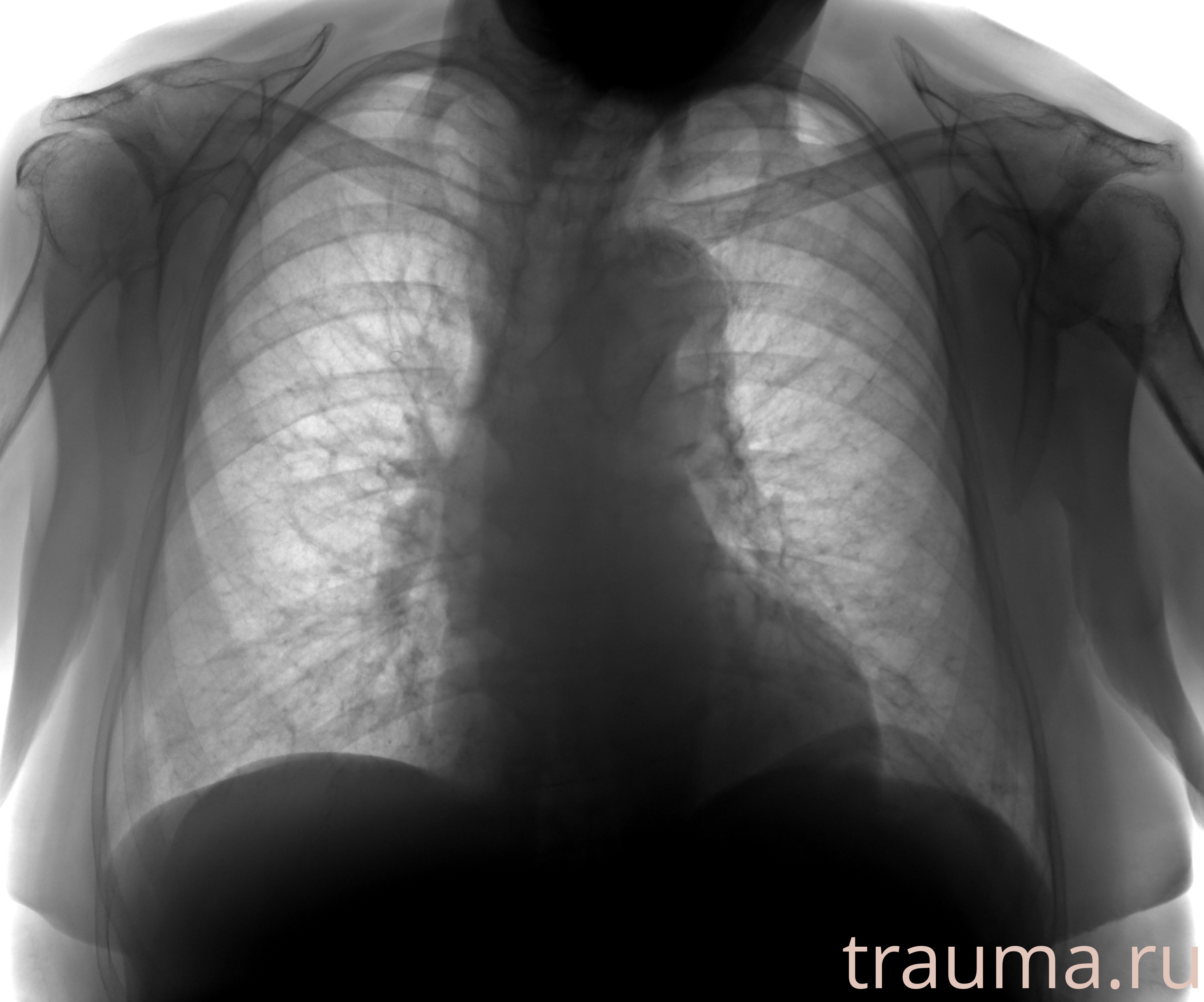 Рентген на дому: по вашему адресу приезжает врач-рентгенолог, травматолог-ортопед с мобильным рентгеновским аппаратом, проводит диагностику травмы или заболевания, делает необходимые рентгенограммы, дает рекомендации по дальнейшему лечению. Получить качественные снимки в домашних условиях возможно благодаря уникальной методике, разработанной МосРентген Центром для института  Склифосовского