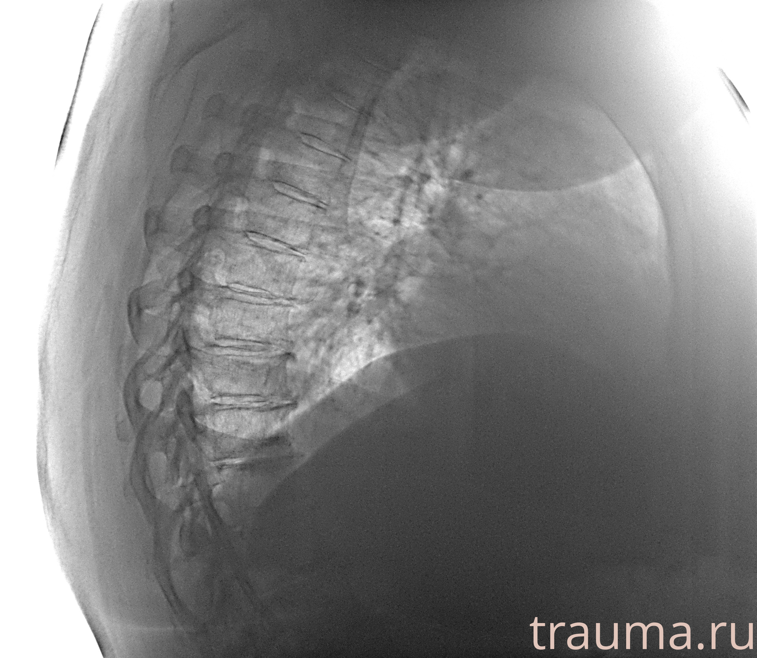 Рентген на дому: по вашему адресу приезжает врач-рентгенолог, травматолог-ортопед с мобильным рентгеновским аппаратом, проводит диагностику травмы или заболевания, делает необходимые рентгенограммы, дает рекомендации по дальнейшему лечению. Получить качественные снимки в домашних условиях возможно благодаря уникальной методике, разработанной МосРентген Центром для института  Склифосовского