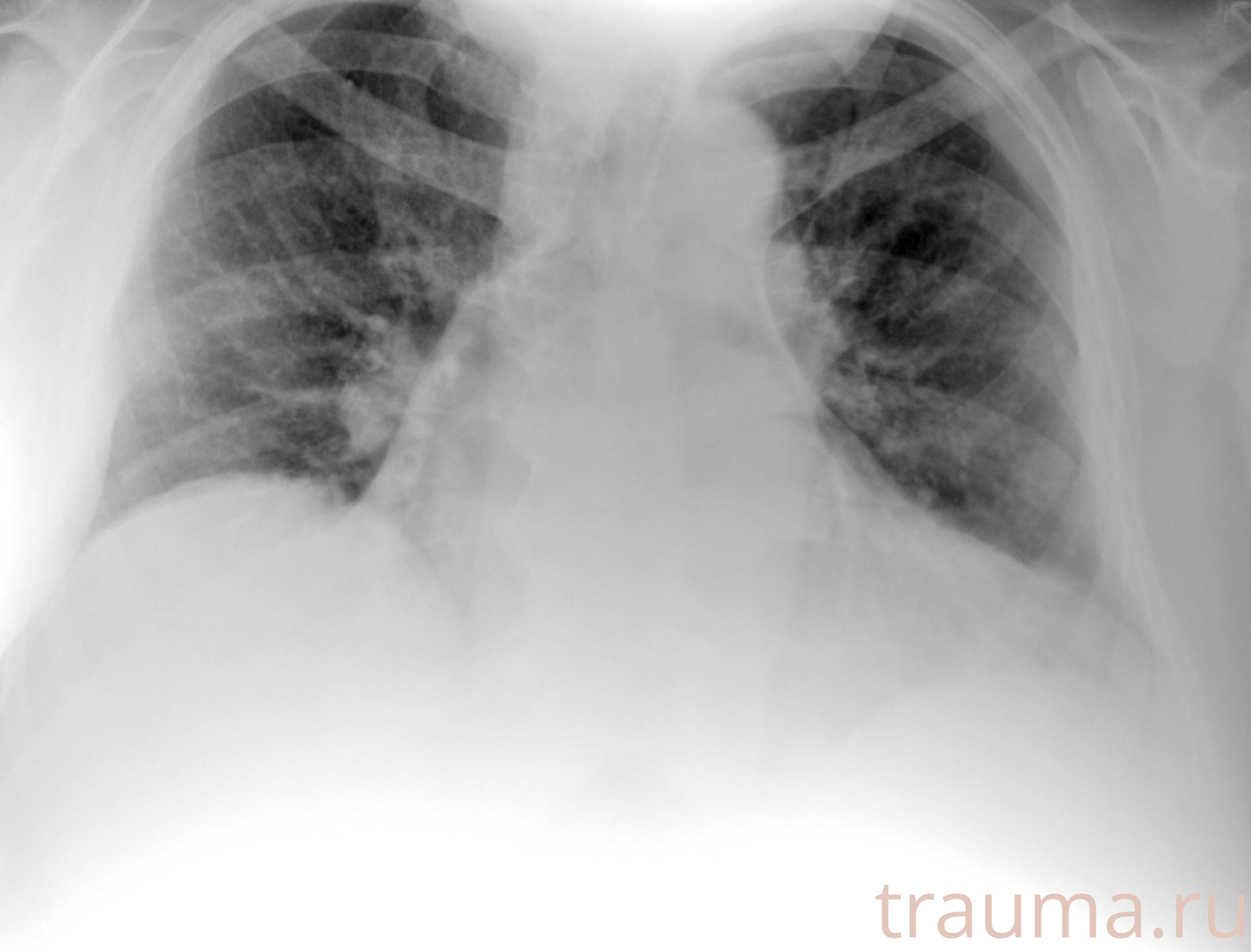 Рентген на дому: по вашему адресу приезжает врач-рентгенолог, травматолог-ортопед с мобильным рентгеновским аппаратом, проводит диагностику травмы или заболевания, делает необходимые рентгенограммы, дает рекомендации по дальнейшему лечению. Получить качественные снимки в домашних условиях возможно благодаря уникальной методике, разработанной МосРентген Центром для института  Склифосовского