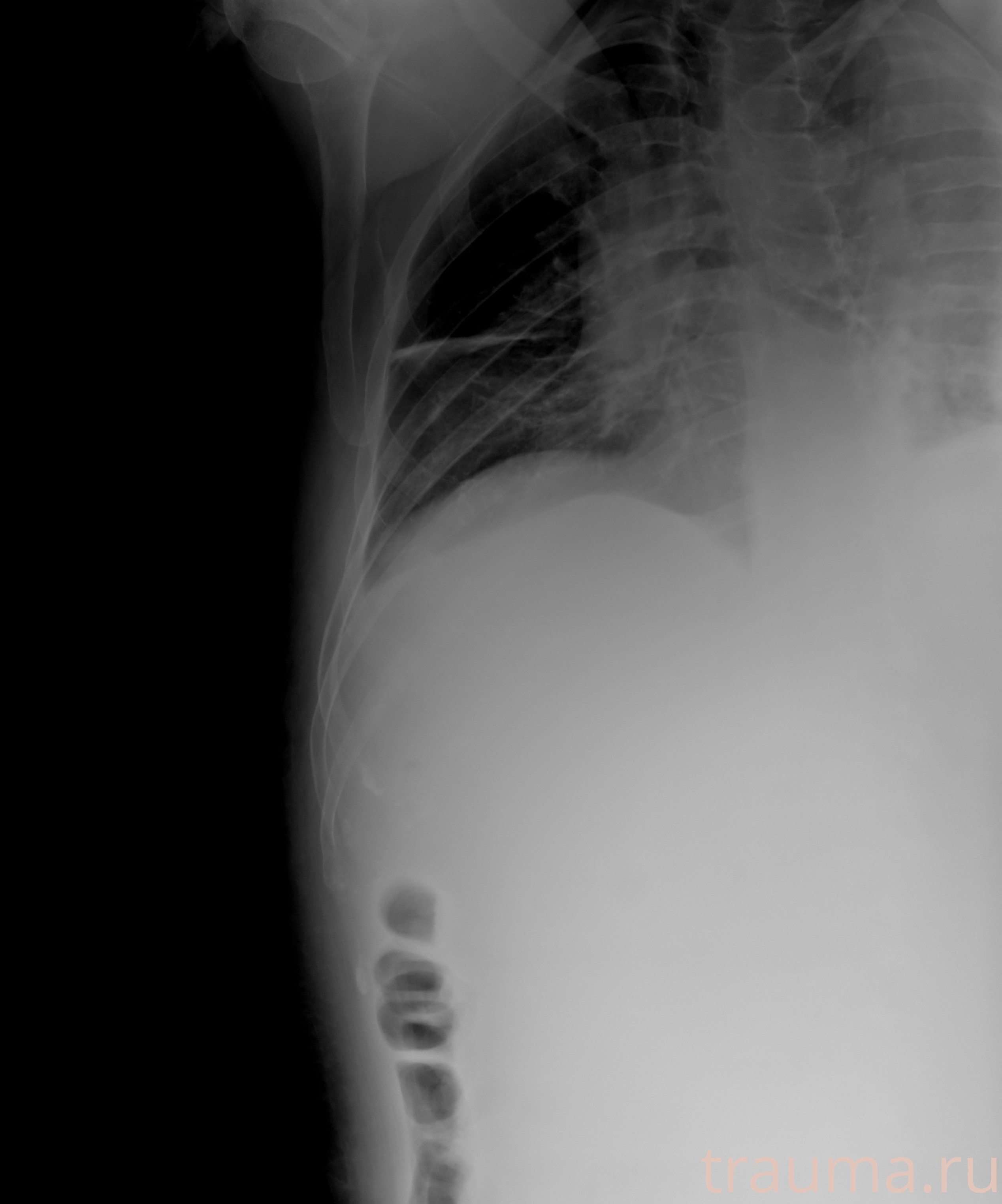 Рентген на дому: по вашему адресу приезжает врач-рентгенолог, травматолог-ортопед с мобильным рентгеновским аппаратом, проводит диагностику травмы или заболевания, делает необходимые рентгенограммы, дает рекомендации по дальнейшему лечению. Получить качественные снимки в домашних условиях возможно благодаря уникальной методике, разработанной МосРентген Центром для института  Склифосовского