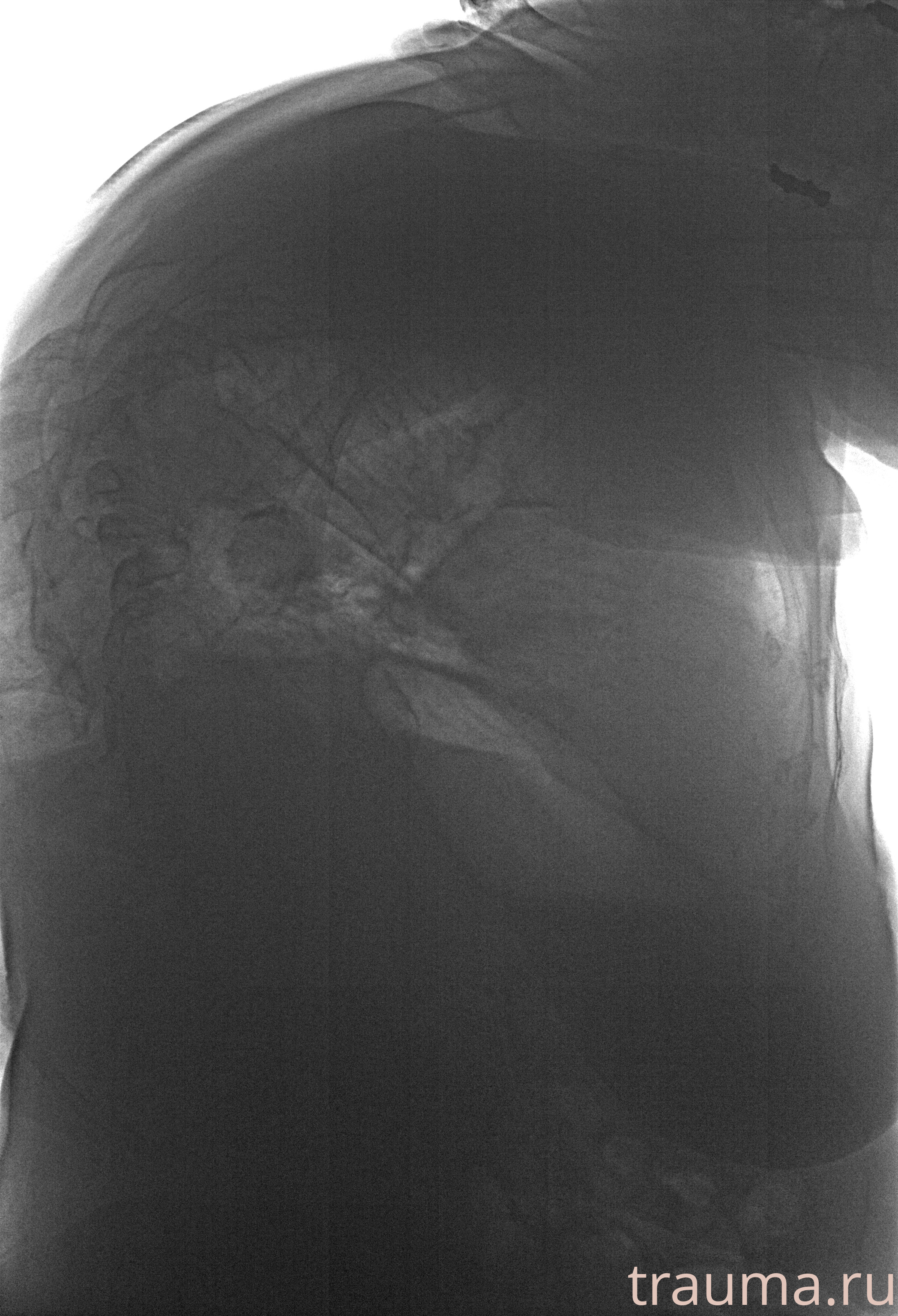 Рентген на дому: по вашему адресу приезжает врач-рентгенолог, травматолог-ортопед с мобильным рентгеновским аппаратом, проводит диагностику травмы или заболевания, делает необходимые рентгенограммы, дает рекомендации по дальнейшему лечению. Получить качественные снимки в домашних условиях возможно благодаря уникальной методике, разработанной МосРентген Центром для института  Склифосовского