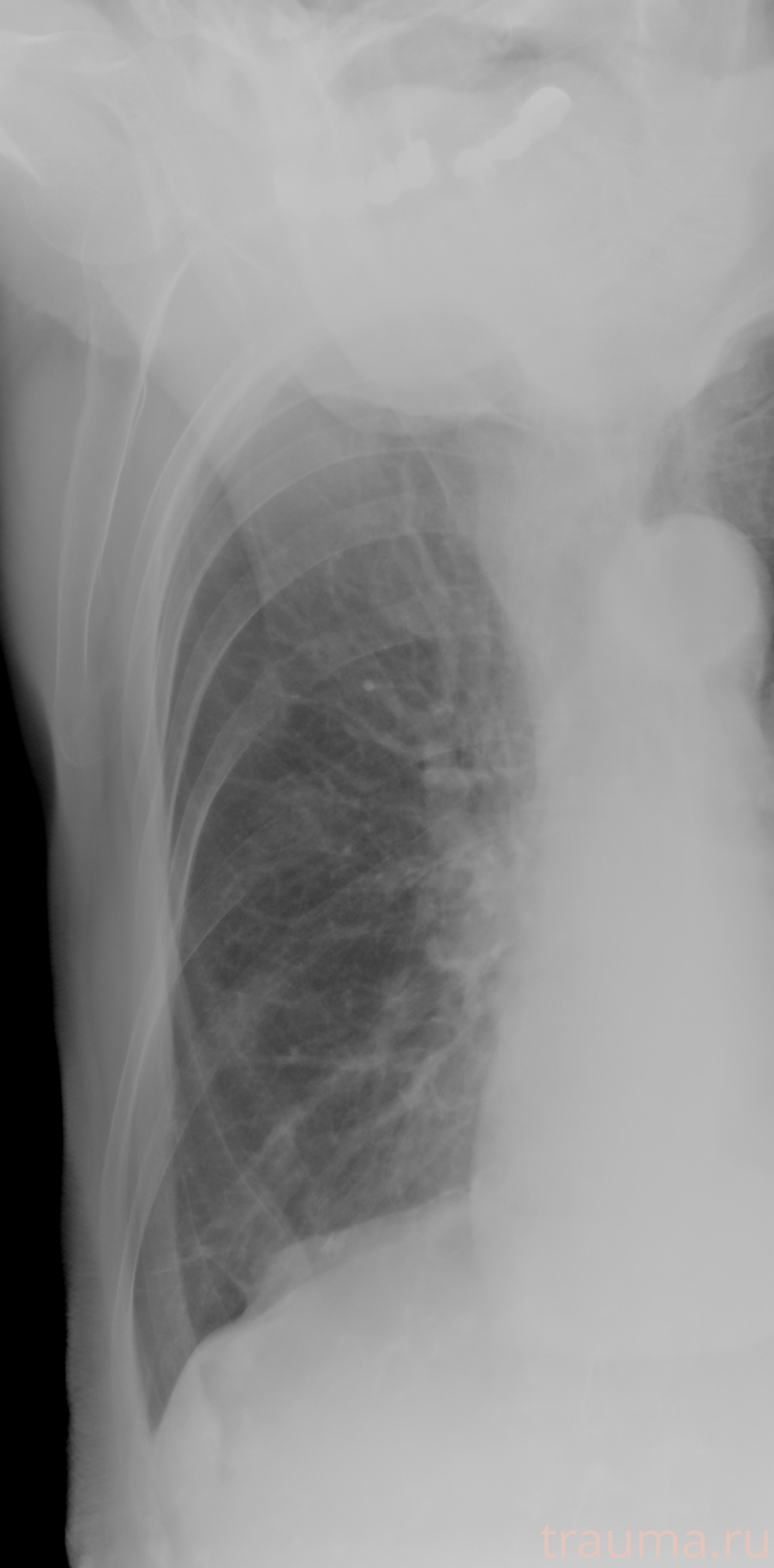 Рентген на дому: по вашему адресу приезжает врач-рентгенолог, травматолог-ортопед с мобильным рентгеновским аппаратом, проводит диагностику травмы или заболевания, делает необходимые рентгенограммы, дает рекомендации по дальнейшему лечению. Получить качественные снимки в домашних условиях возможно благодаря уникальной методике, разработанной МосРентген Центром для института  Склифосовского