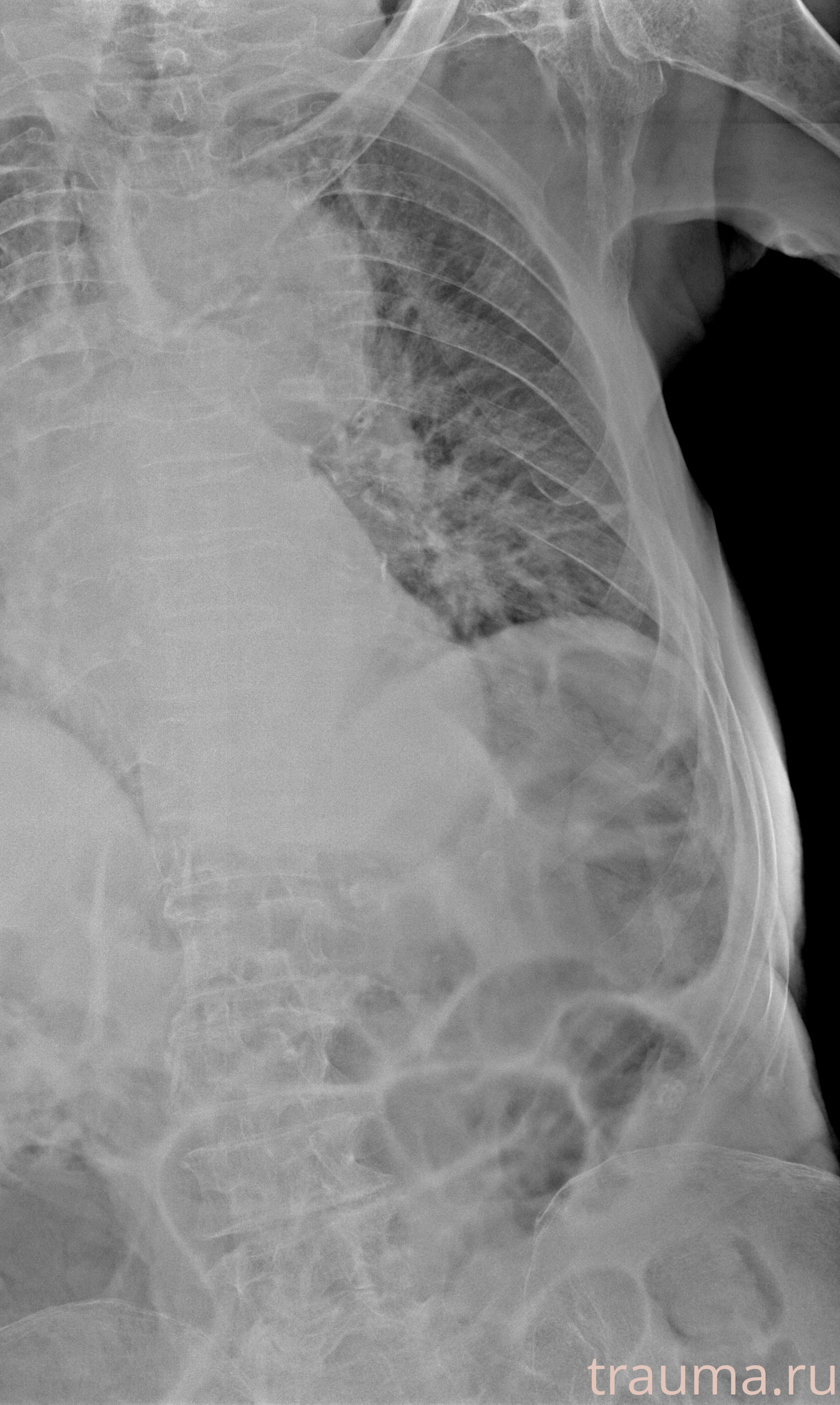 Рентген на дому: по вашему адресу приезжает врач-рентгенолог, травматолог-ортопед с мобильным рентгеновским аппаратом, проводит диагностику травмы или заболевания, делает необходимые рентгенограммы, дает рекомендации по дальнейшему лечению. Получить качественные снимки в домашних условиях возможно благодаря уникальной методике, разработанной МосРентген Центром для института  Склифосовского