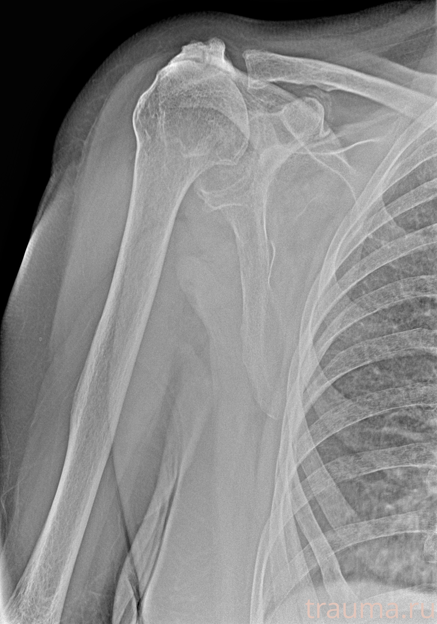 Рентген на дому: по вашему адресу приезжает врач-рентгенолог, травматолог-ортопед с мобильным рентгеновским аппаратом, проводит диагностику травмы или заболевания, делает необходимые рентгенограммы, дает рекомендации по дальнейшему лечению. Получить качественные снимки в домашних условиях возможно благодаря уникальной методике, разработанной МосРентген Центром для института  Склифосовского