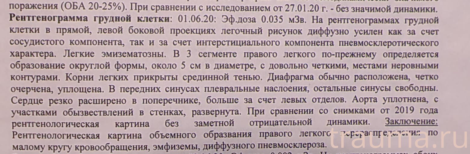 Рентген на дому: по вашему адресу приезжает врач-рентгенолог, травматолог-ортопед с мобильным рентгеновским аппаратом, проводит диагностику травмы или заболевания, делает необходимые рентгенограммы, дает рекомендации по дальнейшему лечению. Получить качественные снимки в домашних условиях возможно благодаря уникальной методике, разработанной МосРентген Центром для института  Склифосовского