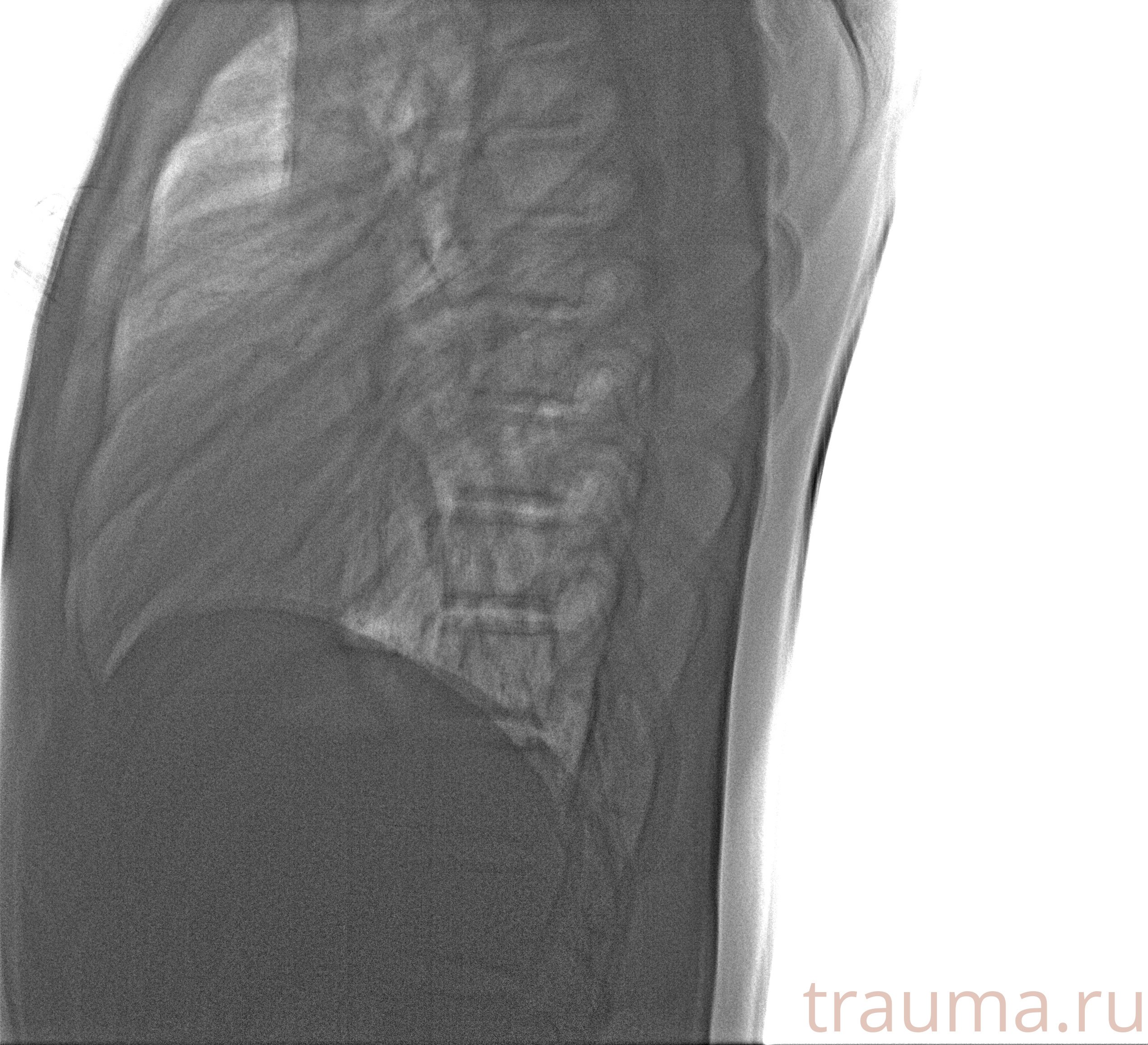 Рентген на дому: по вашему адресу приезжает врач-рентгенолог, травматолог-ортопед с мобильным рентгеновским аппаратом, проводит диагностику травмы или заболевания, делает необходимые рентгенограммы, дает рекомендации по дальнейшему лечению. Получить качественные снимки в домашних условиях возможно благодаря уникальной методике, разработанной МосРентген Центром для института  Склифосовского