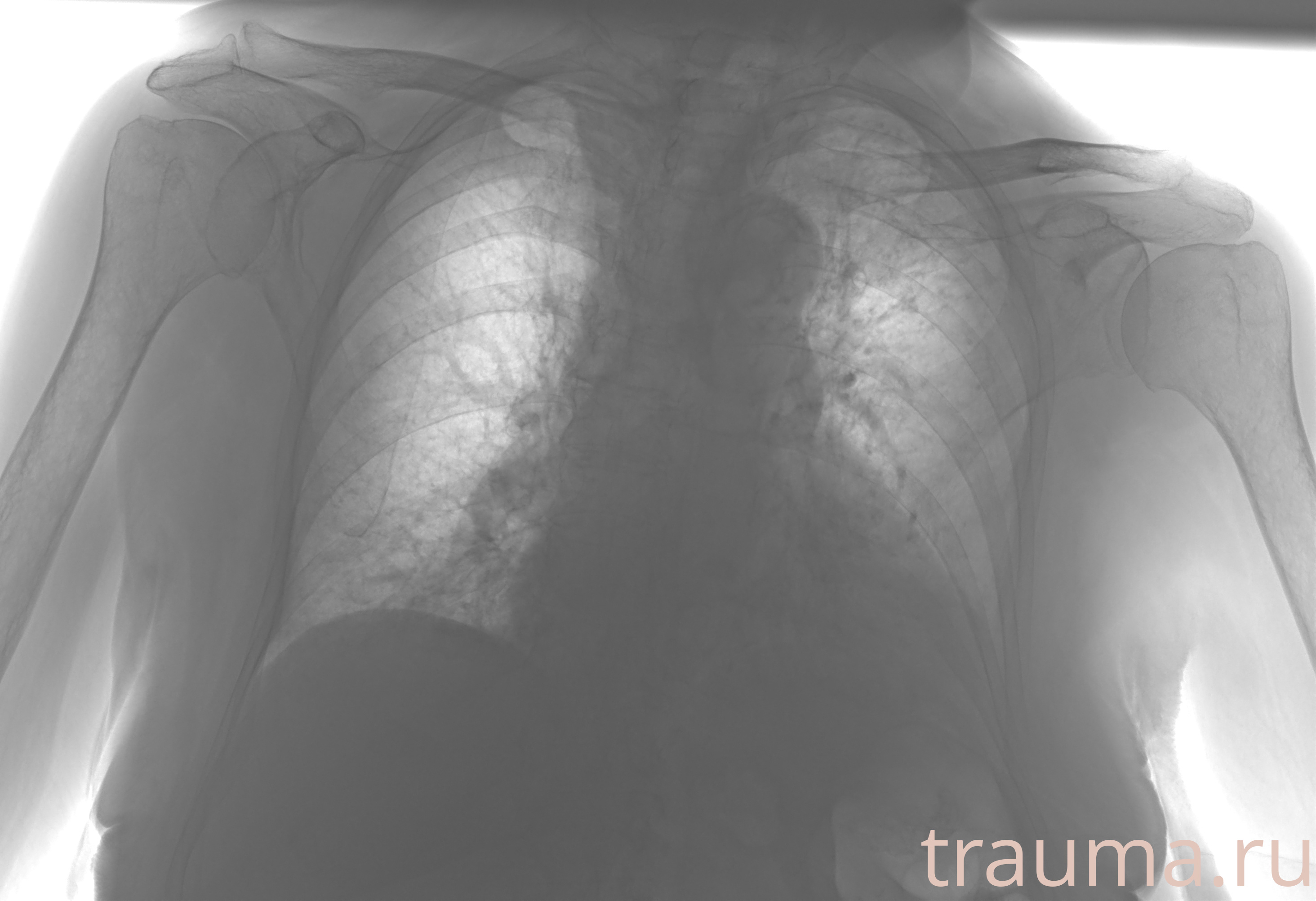 Рентген на дому: по вашему адресу приезжает врач-рентгенолог, травматолог-ортопед с мобильным рентгеновским аппаратом, проводит диагностику травмы или заболевания, делает необходимые рентгенограммы, дает рекомендации по дальнейшему лечению. Получить качественные снимки в домашних условиях возможно благодаря уникальной методике, разработанной МосРентген Центром для института  Склифосовского