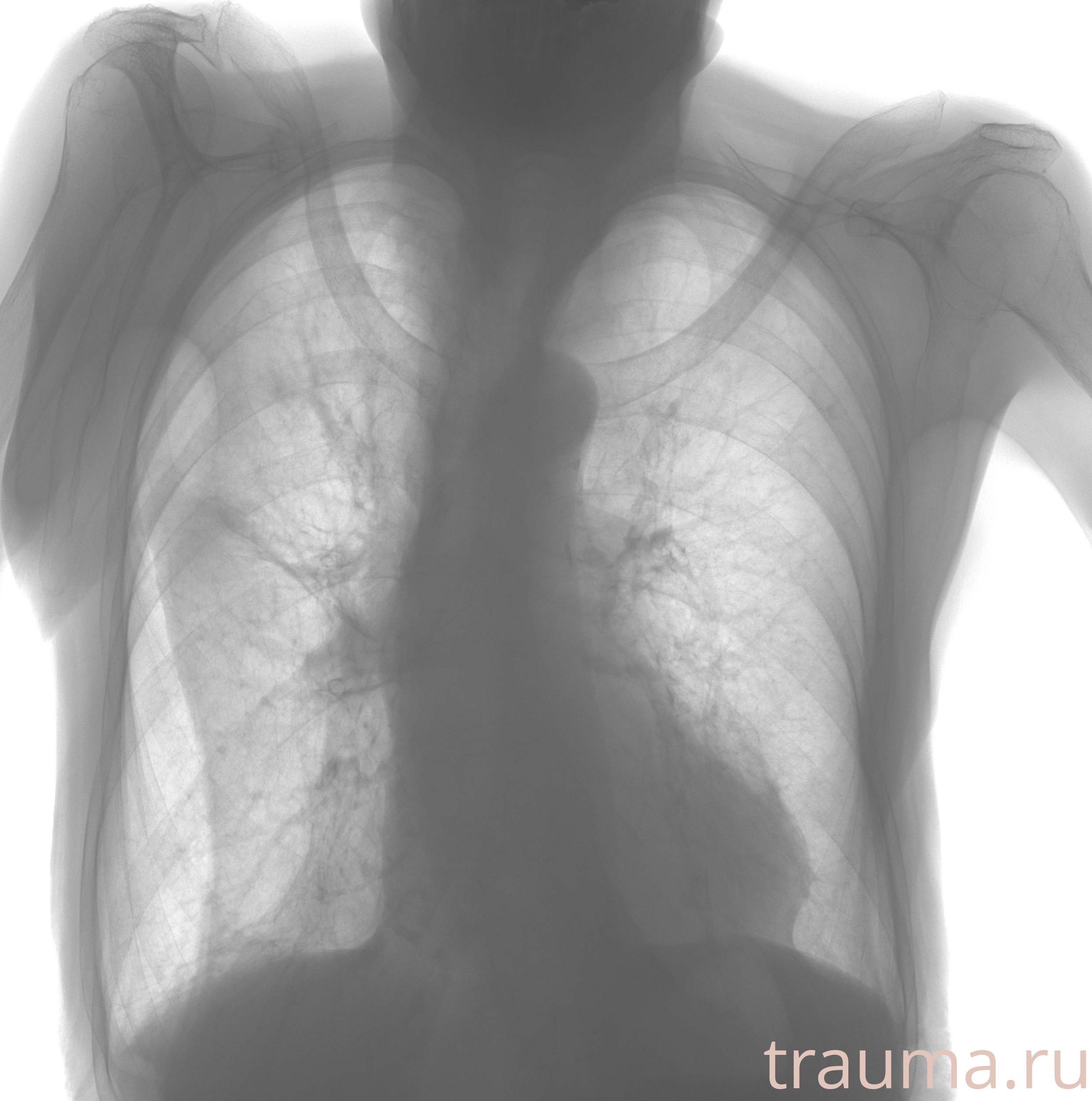 Рентген на дому: по вашему адресу приезжает врач-рентгенолог, травматолог-ортопед с мобильным рентгеновским аппаратом, проводит диагностику травмы или заболевания, делает необходимые рентгенограммы, дает рекомендации по дальнейшему лечению. Получить качественные снимки в домашних условиях возможно благодаря уникальной методике, разработанной МосРентген Центром для института  Склифосовского