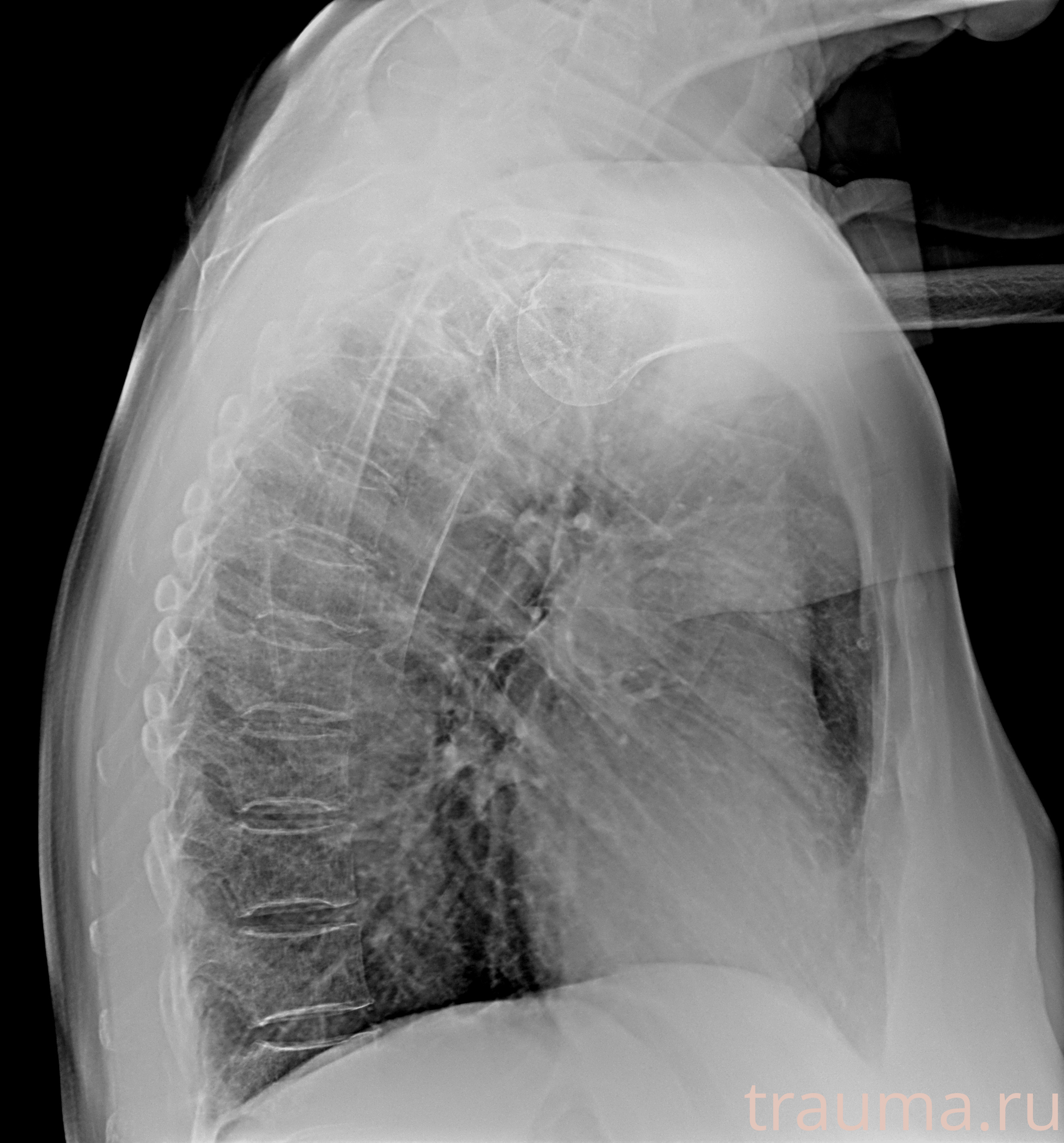 Рентген на дому: по вашему адресу приезжает врач-рентгенолог, травматолог-ортопед с мобильным рентгеновским аппаратом, проводит диагностику травмы или заболевания, делает необходимые рентгенограммы, дает рекомендации по дальнейшему лечению. Получить качественные снимки в домашних условиях возможно благодаря уникальной методике, разработанной МосРентген Центром для института  Склифосовского