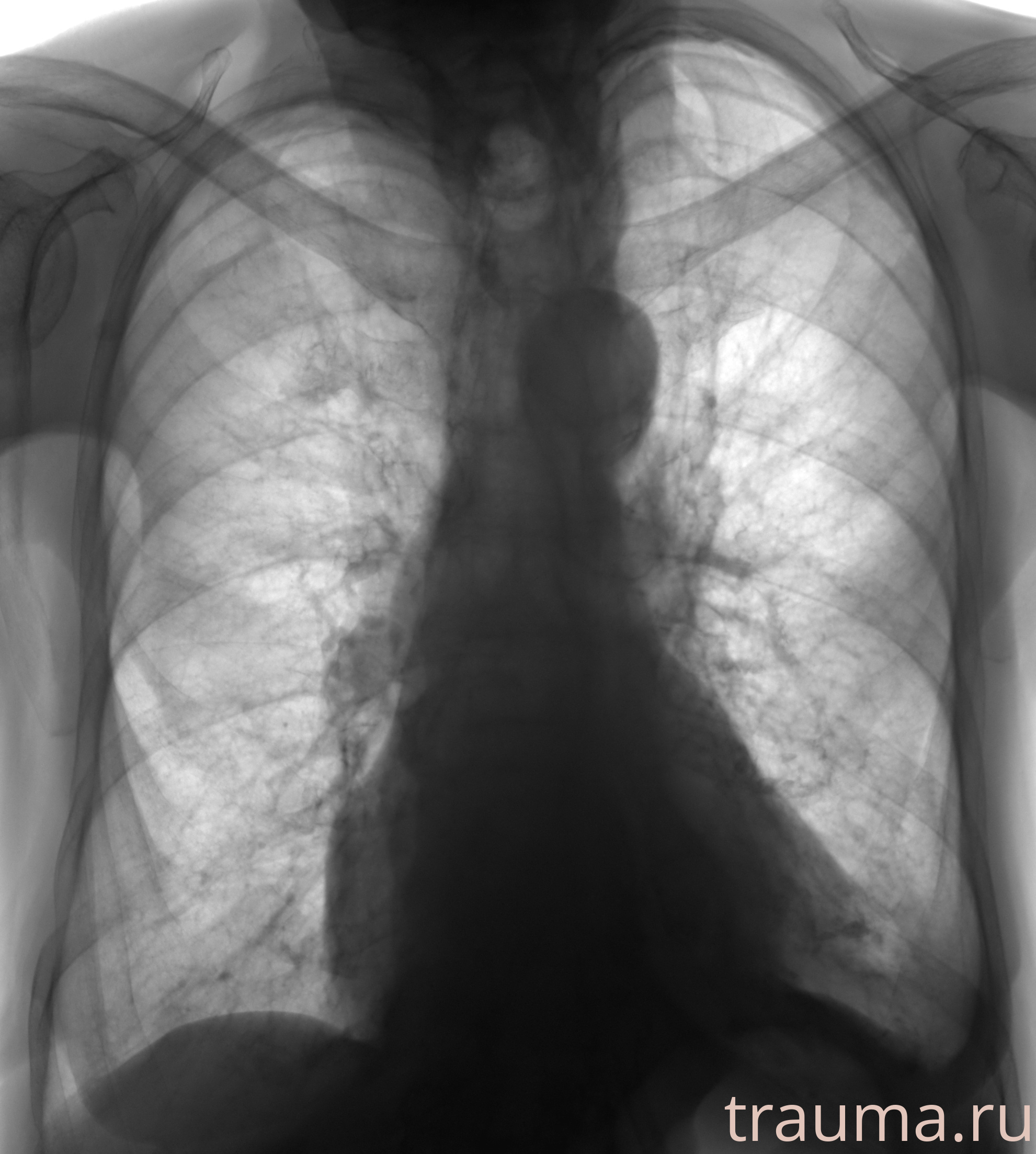 Рентген на дому: по вашему адресу приезжает врач-рентгенолог, травматолог-ортопед с мобильным рентгеновским аппаратом, проводит диагностику травмы или заболевания, делает необходимые рентгенограммы, дает рекомендации по дальнейшему лечению. Получить качественные снимки в домашних условиях возможно благодаря уникальной методике, разработанной МосРентген Центром для института  Склифосовского