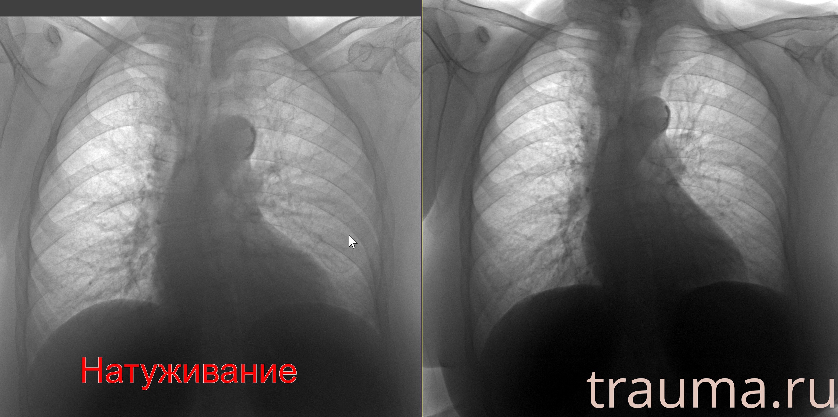 Рентген на дому: по вашему адресу приезжает врач-рентгенолог, травматолог-ортопед с мобильным рентгеновским аппаратом, проводит диагностику травмы или заболевания, делает необходимые рентгенограммы, дает рекомендации по дальнейшему лечению. Получить качественные снимки в домашних условиях возможно благодаря уникальной методике, разработанной МосРентген Центром для института  Склифосовского