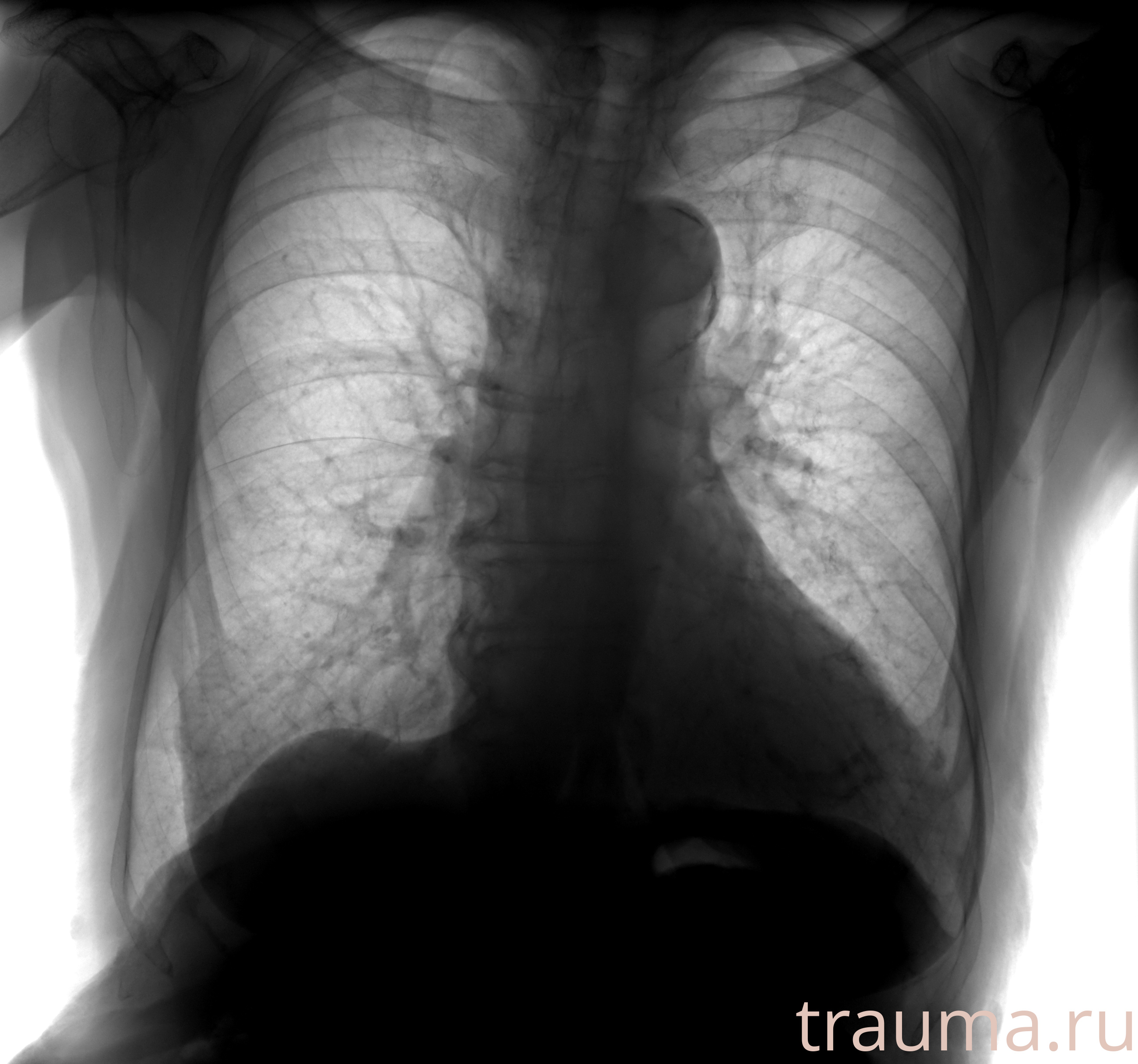 Рентген на дому: по вашему адресу приезжает врач-рентгенолог, травматолог-ортопед с мобильным рентгеновским аппаратом, проводит диагностику травмы или заболевания, делает необходимые рентгенограммы, дает рекомендации по дальнейшему лечению. Получить качественные снимки в домашних условиях возможно благодаря уникальной методике, разработанной МосРентген Центром для института  Склифосовского