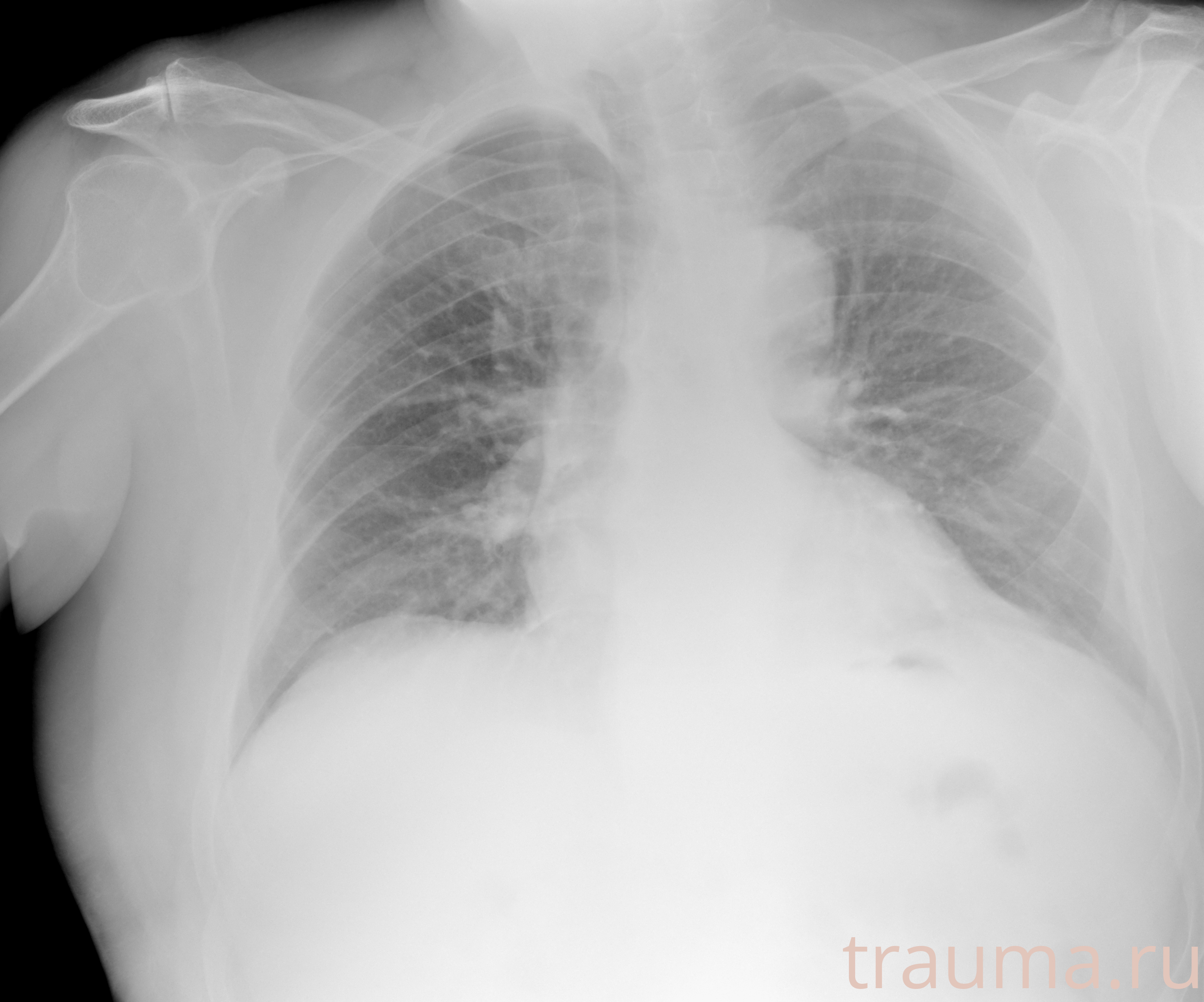 Рентген на дому: по вашему адресу приезжает врач-рентгенолог, травматолог-ортопед с мобильным рентгеновским аппаратом, проводит диагностику травмы или заболевания, делает необходимые рентгенограммы, дает рекомендации по дальнейшему лечению. Получить качественные снимки в домашних условиях возможно благодаря уникальной методике, разработанной МосРентген Центром для института  Склифосовского