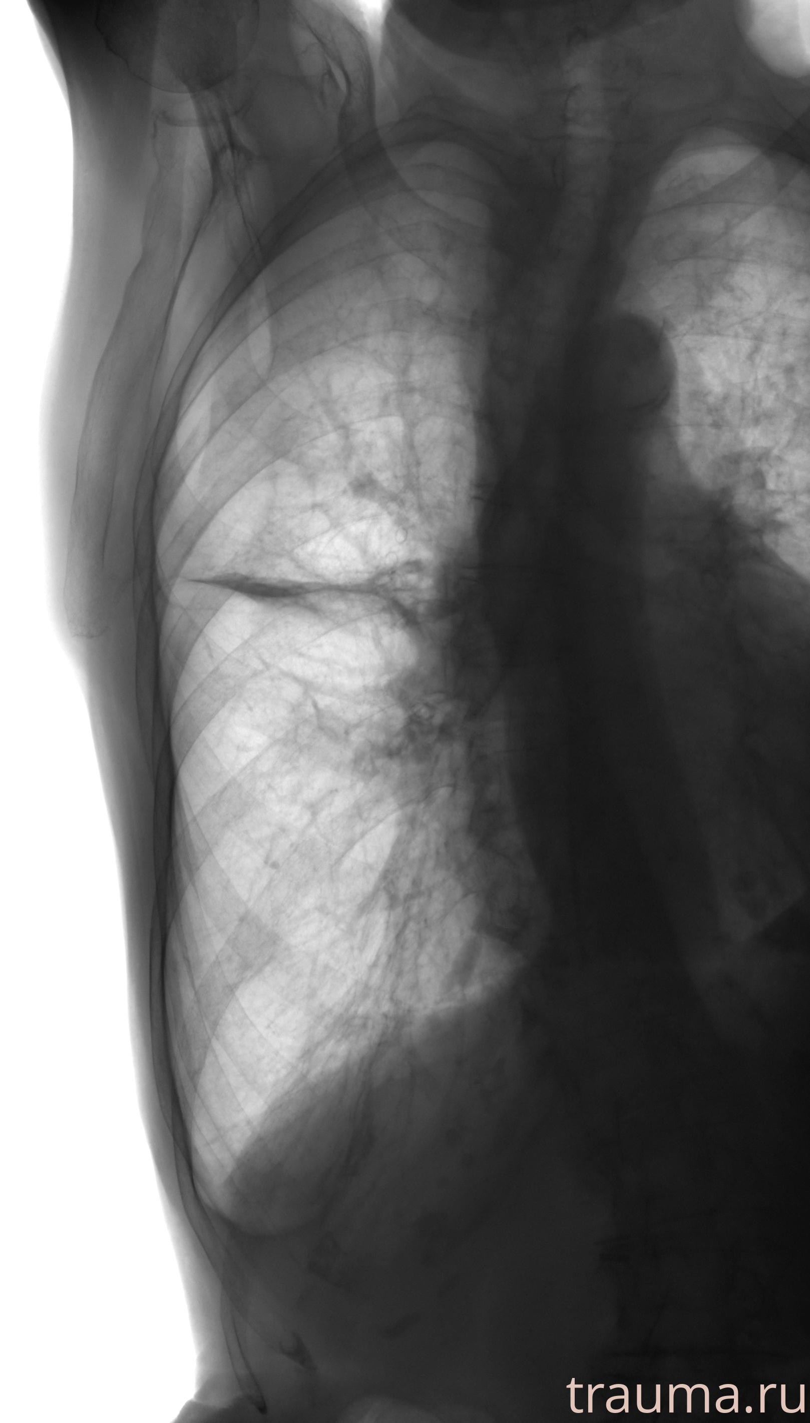 Рентген на дому: по вашему адресу приезжает врач-рентгенолог, травматолог-ортопед с мобильным рентгеновским аппаратом, проводит диагностику травмы или заболевания, делает необходимые рентгенограммы, дает рекомендации по дальнейшему лечению. Получить качественные снимки в домашних условиях возможно благодаря уникальной методике, разработанной МосРентген Центром для института  Склифосовского