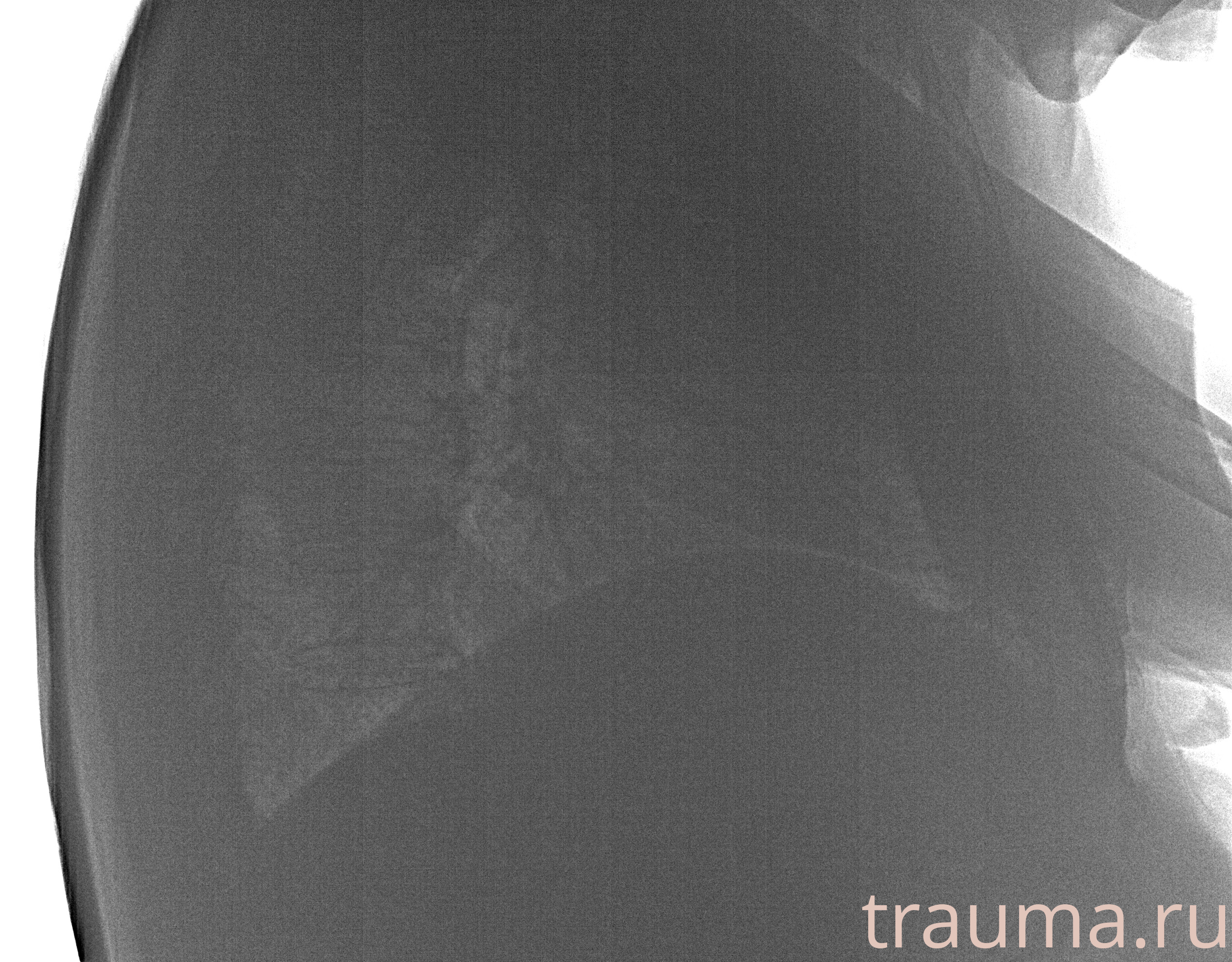 Рентген на дому: по вашему адресу приезжает врач-рентгенолог, травматолог-ортопед с мобильным рентгеновским аппаратом, проводит диагностику травмы или заболевания, делает необходимые рентгенограммы, дает рекомендации по дальнейшему лечению. Получить качественные снимки в домашних условиях возможно благодаря уникальной методике, разработанной МосРентген Центром для института  Склифосовского