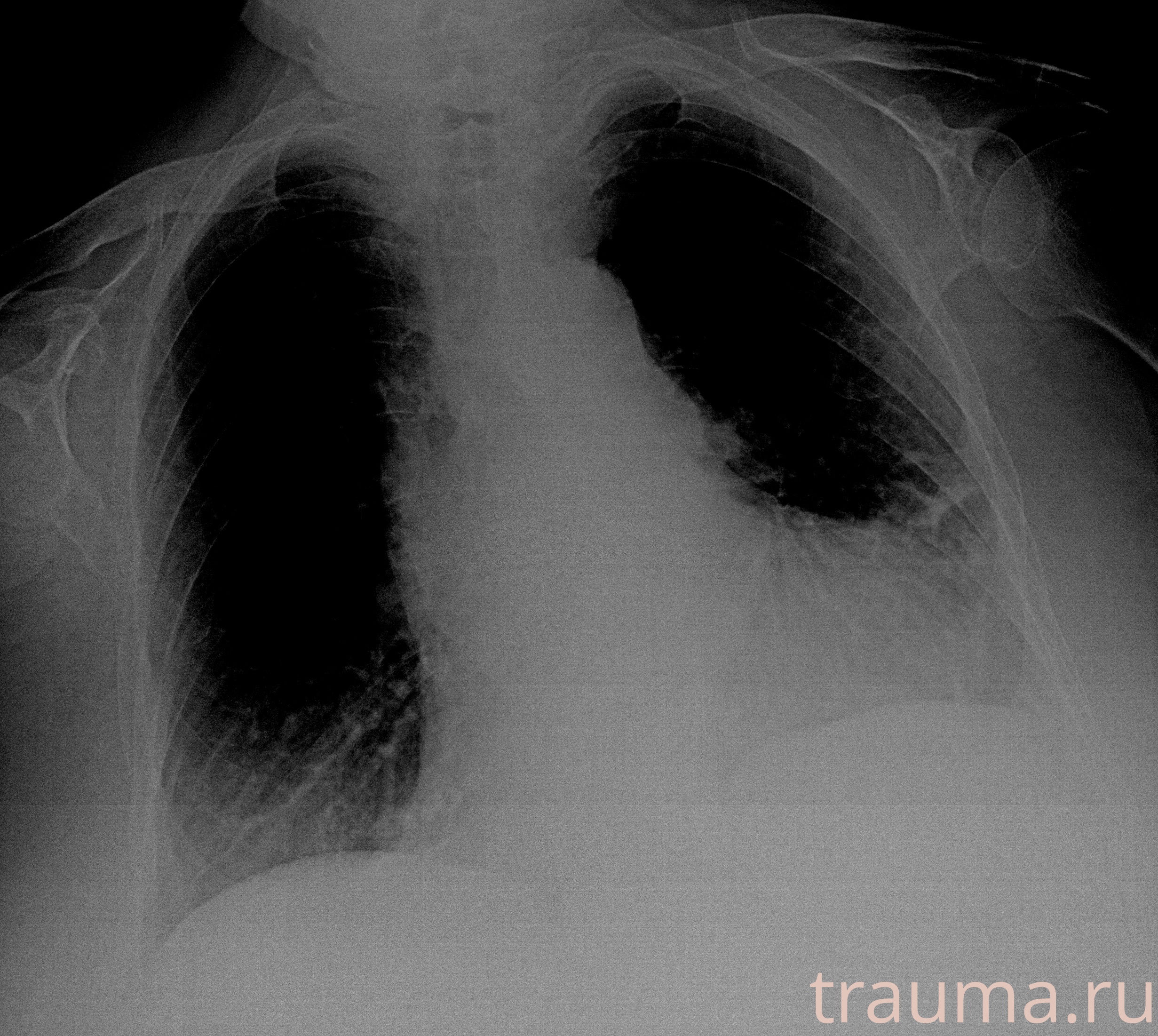 Рентген на дому: по вашему адресу приезжает врач-рентгенолог, травматолог-ортопед с мобильным рентгеновским аппаратом, проводит диагностику травмы или заболевания, делает необходимые рентгенограммы, дает рекомендации по дальнейшему лечению. Получить качественные снимки в домашних условиях возможно благодаря уникальной методике, разработанной МосРентген Центром для института  Склифосовского