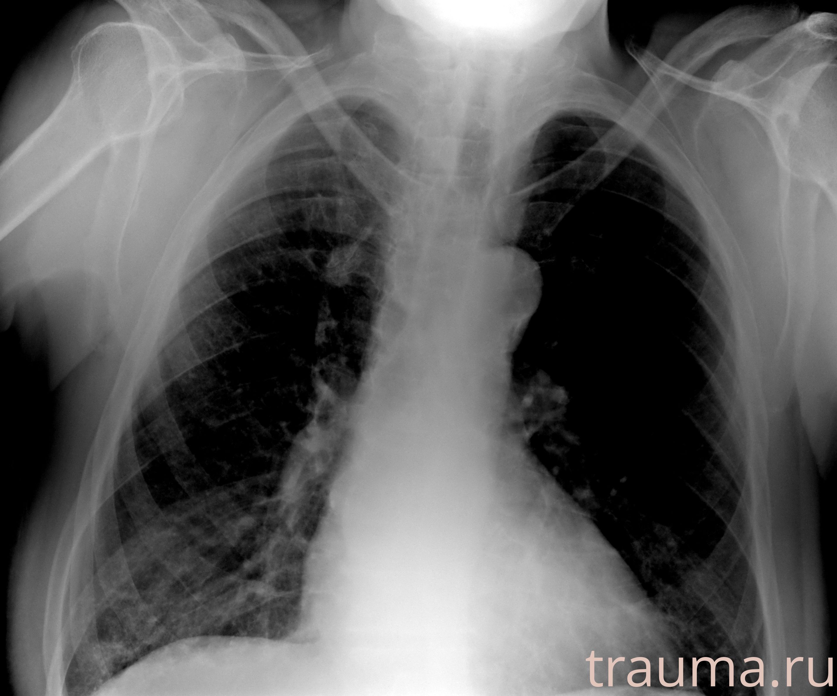 Рентген на дому: по вашему адресу приезжает врач-рентгенолог, травматолог-ортопед с мобильным рентгеновским аппаратом, проводит диагностику травмы или заболевания, делает необходимые рентгенограммы, дает рекомендации по дальнейшему лечению. Получить качественные снимки в домашних условиях возможно благодаря уникальной методике, разработанной МосРентген Центром для института  Склифосовского