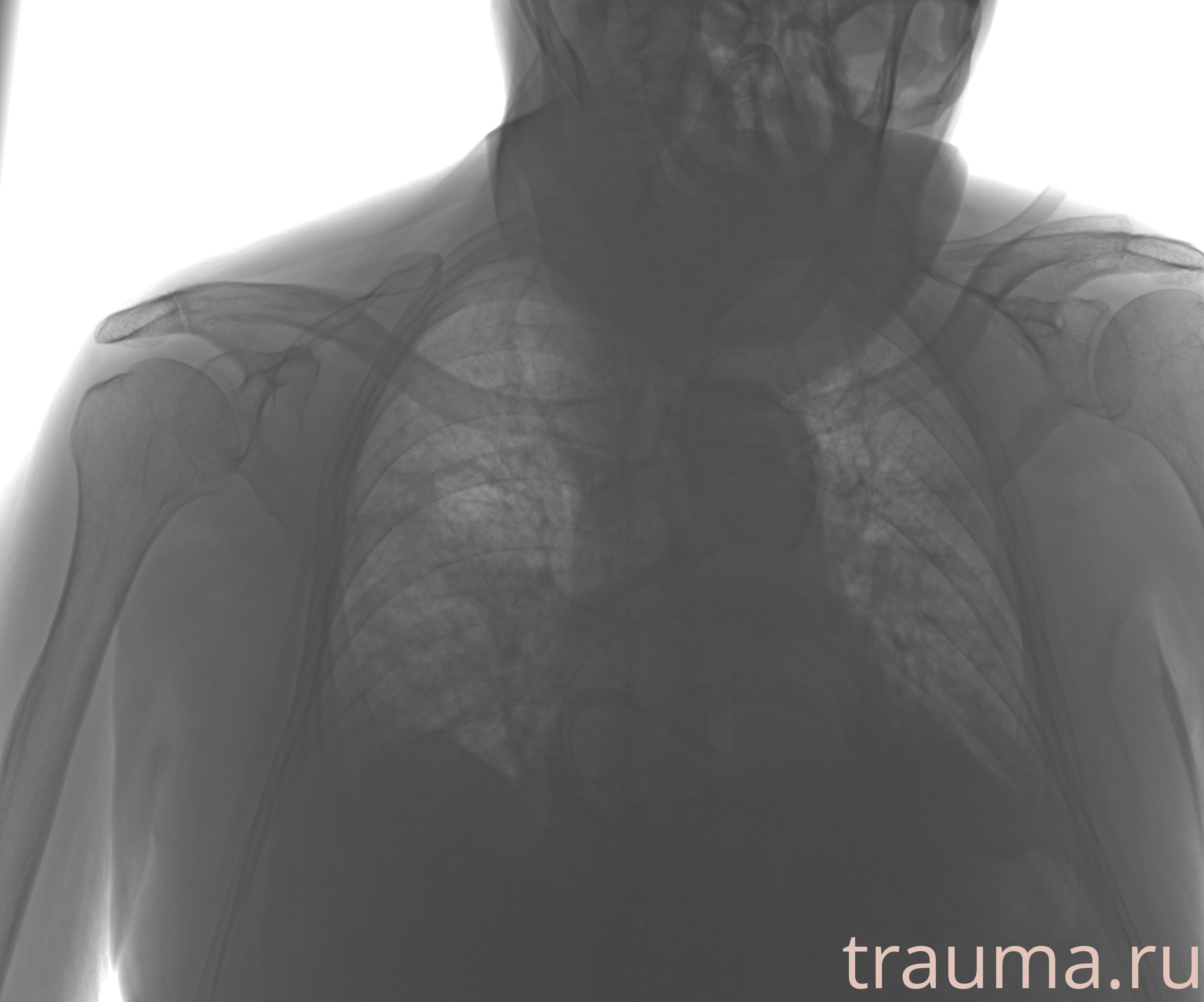 Рентген на дому: по вашему адресу приезжает врач-рентгенолог, травматолог-ортопед с мобильным рентгеновским аппаратом, проводит диагностику травмы или заболевания, делает необходимые рентгенограммы, дает рекомендации по дальнейшему лечению. Получить качественные снимки в домашних условиях возможно благодаря уникальной методике, разработанной МосРентген Центром для института  Склифосовского