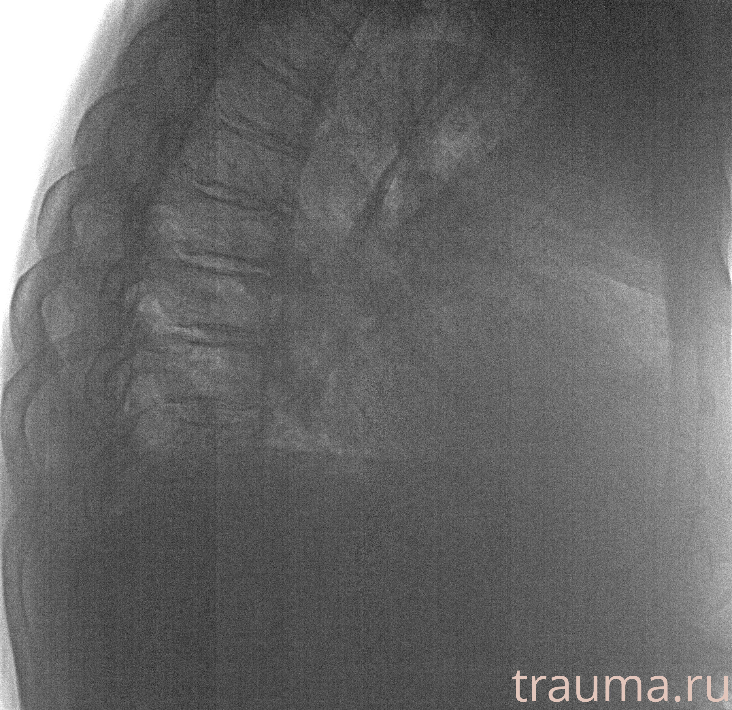 Рентген на дому: по вашему адресу приезжает врач-рентгенолог, травматолог-ортопед с мобильным рентгеновским аппаратом, проводит диагностику травмы или заболевания, делает необходимые рентгенограммы, дает рекомендации по дальнейшему лечению. Получить качественные снимки в домашних условиях возможно благодаря уникальной методике, разработанной МосРентген Центром для института  Склифосовского