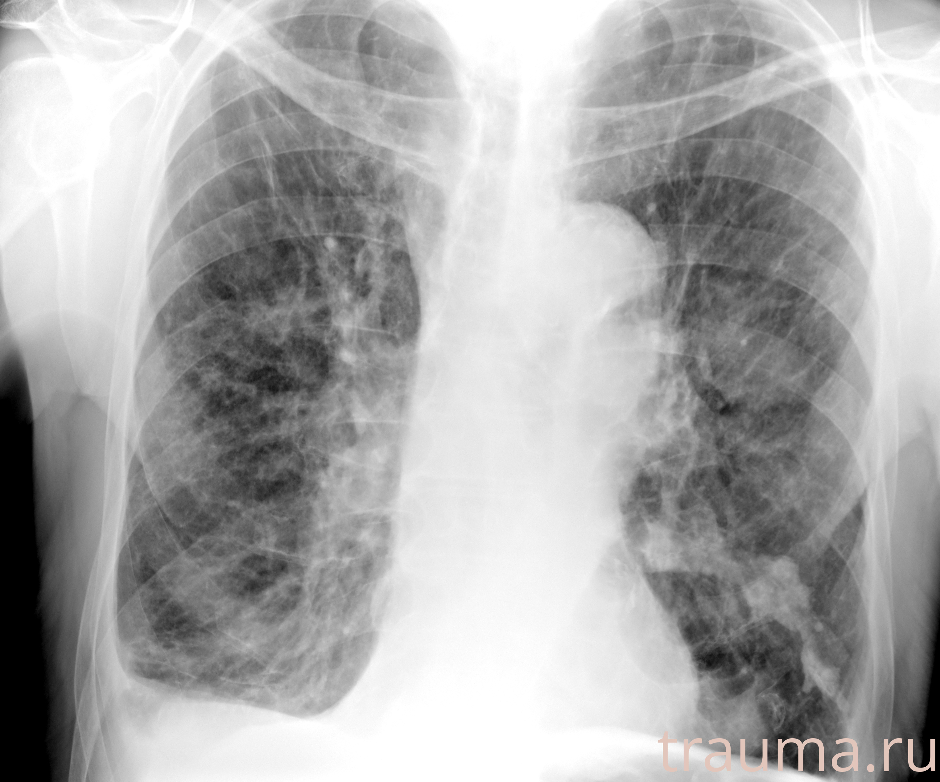 Рентген на дому: по вашему адресу приезжает врач-рентгенолог, травматолог-ортопед с мобильным рентгеновским аппаратом, проводит диагностику травмы или заболевания, делает необходимые рентгенограммы, дает рекомендации по дальнейшему лечению. Получить качественные снимки в домашних условиях возможно благодаря уникальной методике, разработанной МосРентген Центром для института  Склифосовского