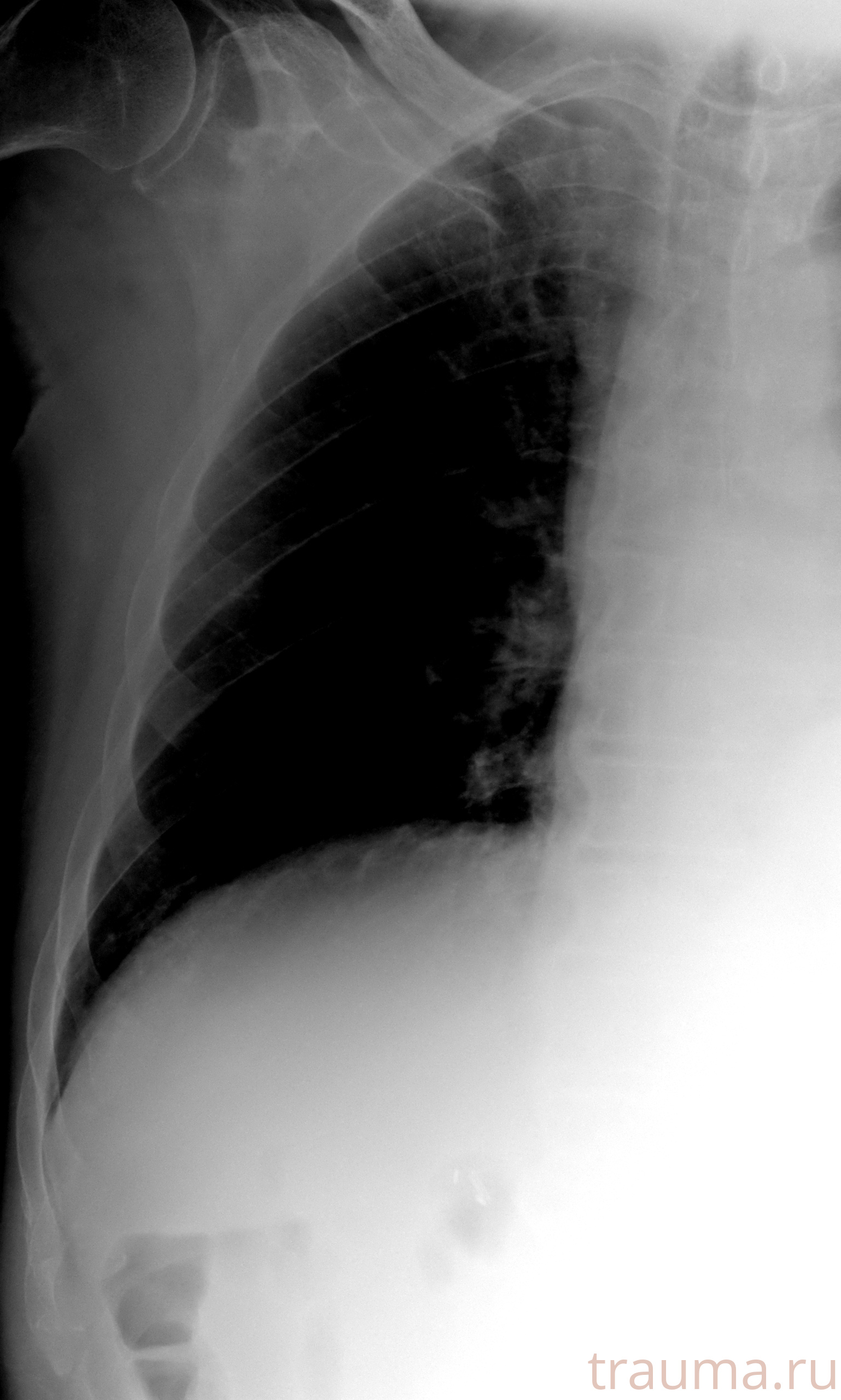 Рентген на дому: по вашему адресу приезжает врач-рентгенолог, травматолог-ортопед с мобильным рентгеновским аппаратом, проводит диагностику травмы или заболевания, делает необходимые рентгенограммы, дает рекомендации по дальнейшему лечению. Получить качественные снимки в домашних условиях возможно благодаря уникальной методике, разработанной МосРентген Центром для института  Склифосовского