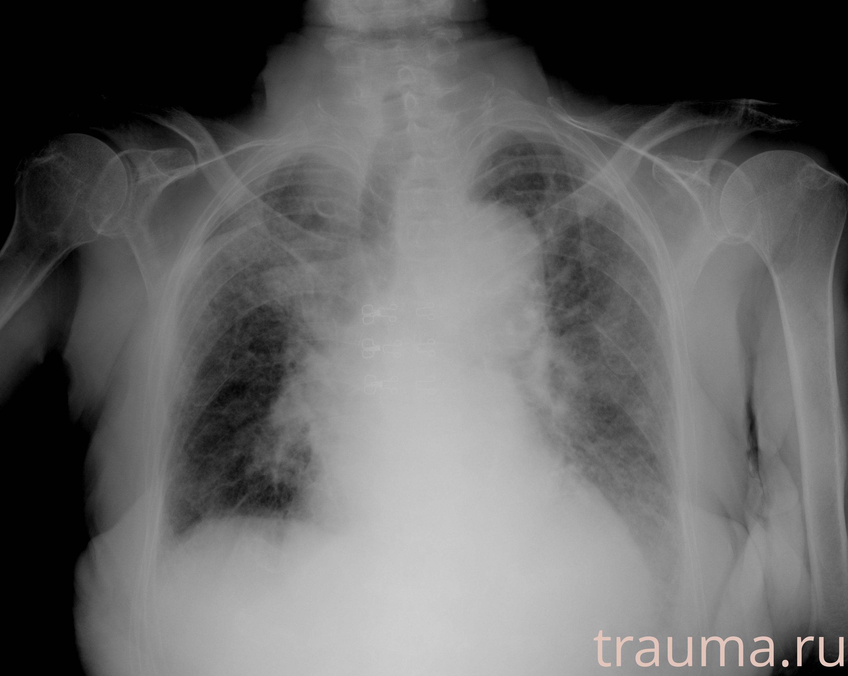 Рентген на дому: по вашему адресу приезжает врач-рентгенолог, травматолог-ортопед с мобильным рентгеновским аппаратом, проводит диагностику травмы или заболевания, делает необходимые рентгенограммы, дает рекомендации по дальнейшему лечению. Получить качественные снимки в домашних условиях возможно благодаря уникальной методике, разработанной МосРентген Центром для института  Склифосовского