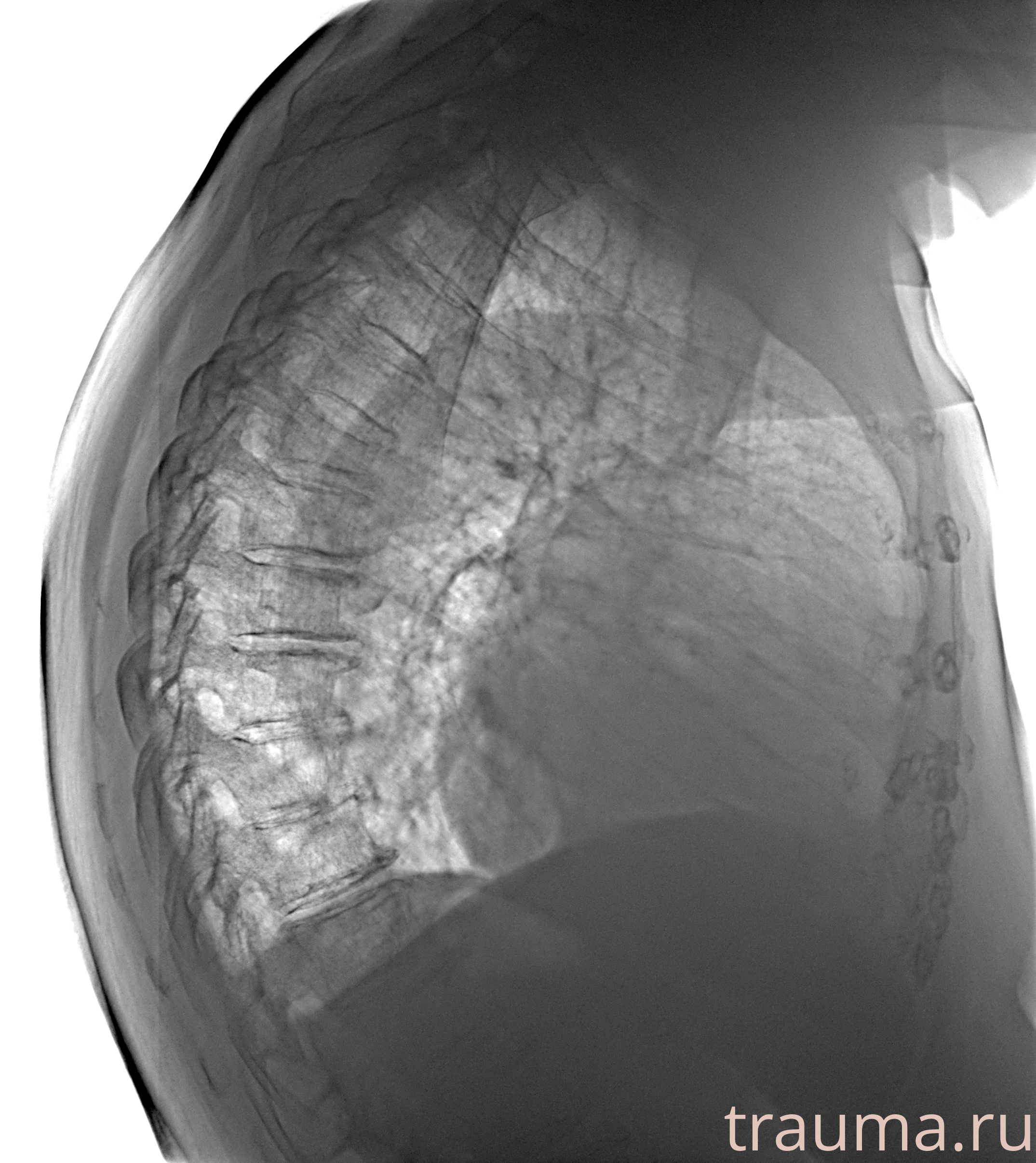 Рентген на дому: по вашему адресу приезжает врач-рентгенолог, травматолог-ортопед с мобильным рентгеновским аппаратом, проводит диагностику травмы или заболевания, делает необходимые рентгенограммы, дает рекомендации по дальнейшему лечению. Получить качественные снимки в домашних условиях возможно благодаря уникальной методике, разработанной МосРентген Центром для института  Склифосовского