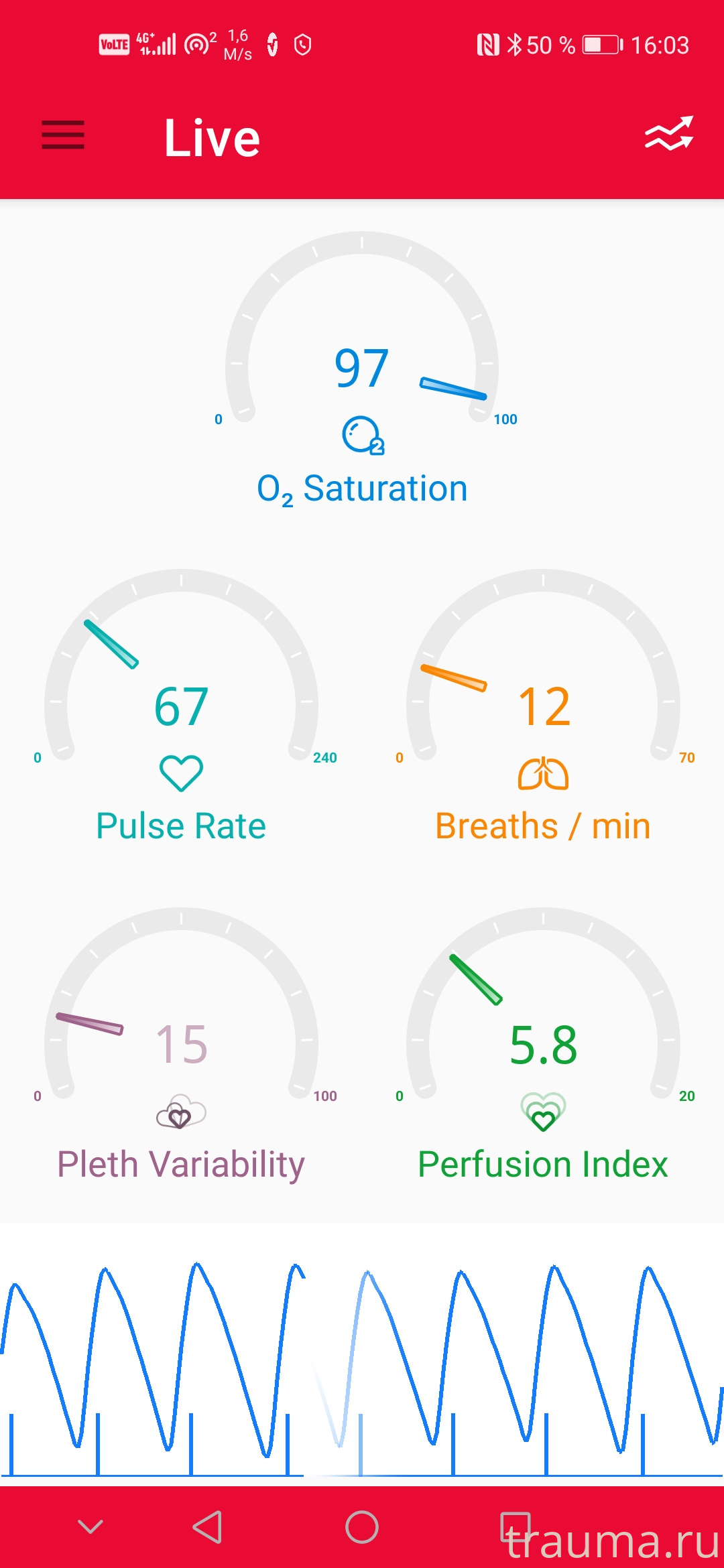 Рентген на дому: по вашему адресу приезжает врач-рентгенолог, травматолог-ортопед с мобильным рентгеновским аппаратом, проводит диагностику травмы или заболевания, делает необходимые рентгенограммы, дает рекомендации по дальнейшему лечению. Получить качественные снимки в домашних условиях возможно благодаря уникальной методике, разработанной МосРентген Центром для института  Склифосовского