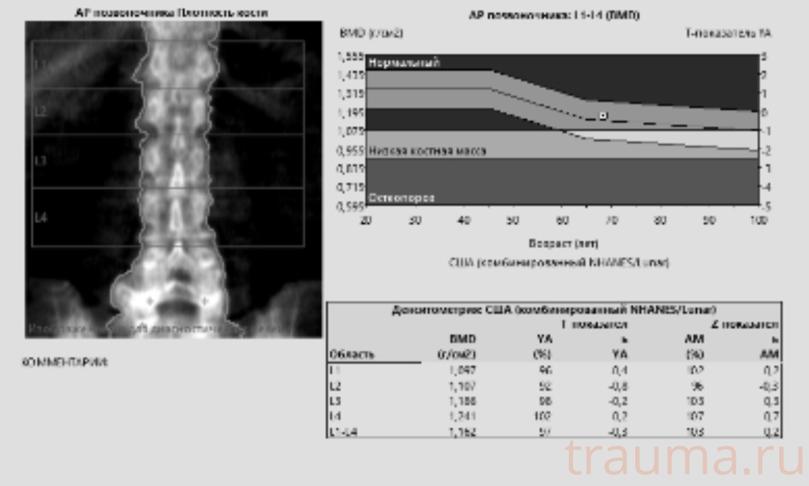 Рентген на дому: по вашему адресу приезжает врач-рентгенолог, травматолог-ортопед с мобильным рентгеновским аппаратом, проводит диагностику травмы или заболевания, делает необходимые рентгенограммы, дает рекомендации по дальнейшему лечению. Получить качественные снимки в домашних условиях возможно благодаря уникальной методике, разработанной МосРентген Центром для института  Склифосовского