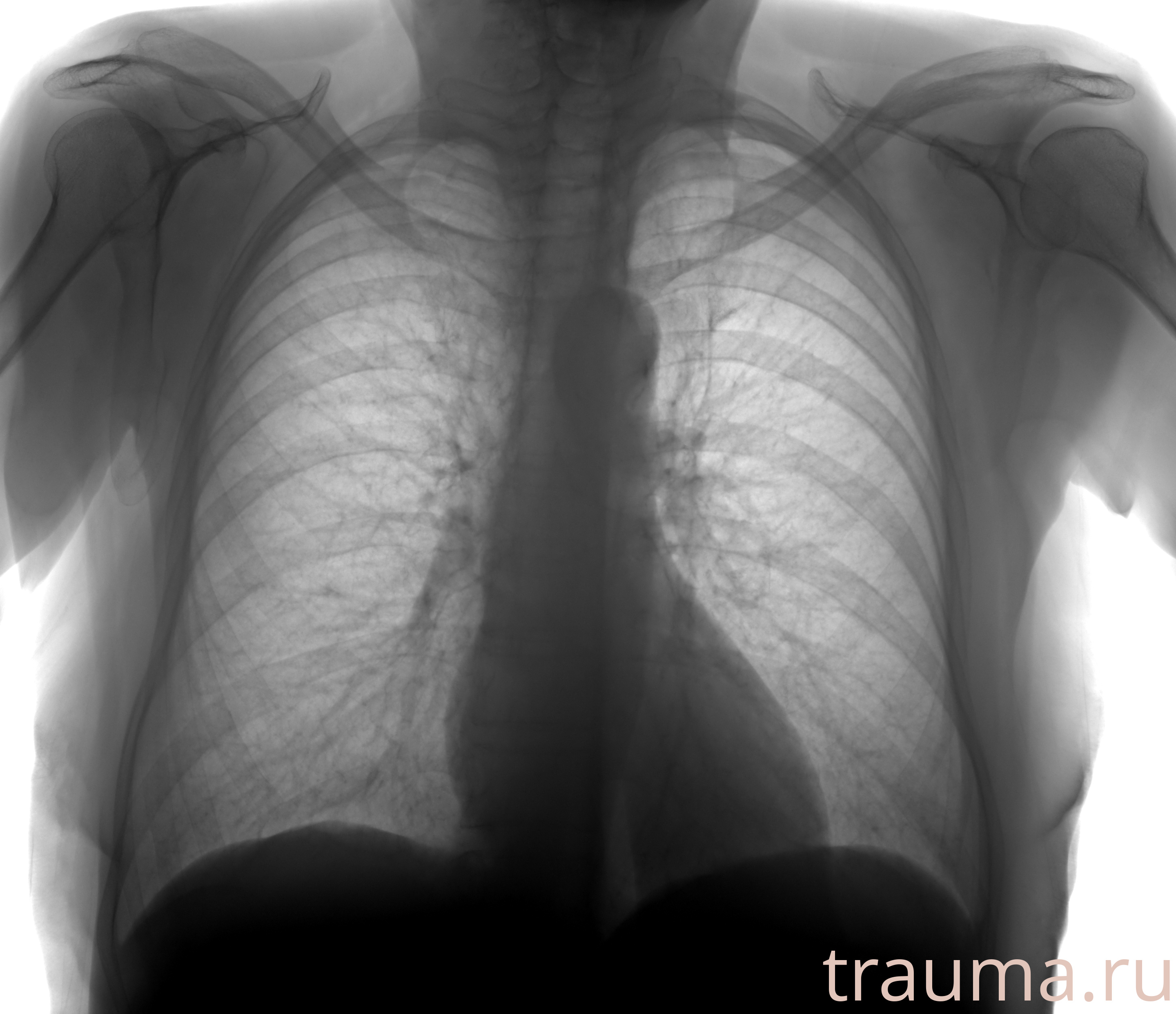 Рентген на дому: по вашему адресу приезжает врач-рентгенолог, травматолог-ортопед с мобильным рентгеновским аппаратом, проводит диагностику травмы или заболевания, делает необходимые рентгенограммы, дает рекомендации по дальнейшему лечению. Получить качественные снимки в домашних условиях возможно благодаря уникальной методике, разработанной МосРентген Центром для института  Склифосовского