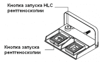 Выбор рентгеноскопии
Выбор рентгеноскопии