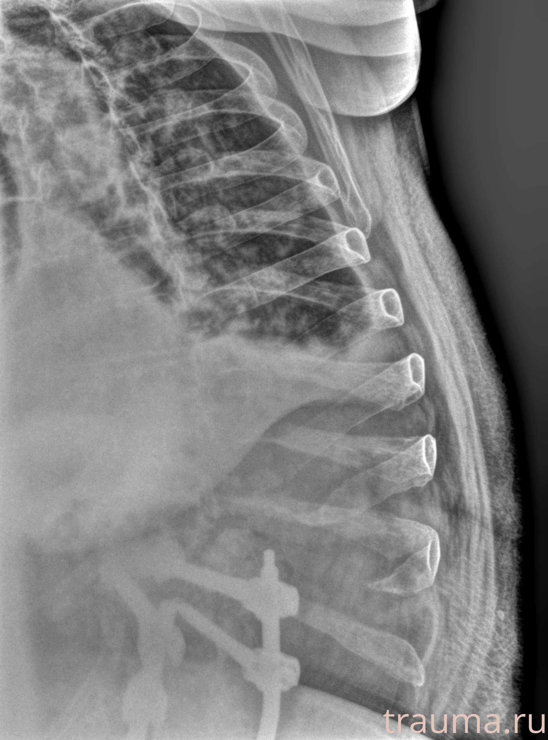 Рентген на дому: по вашему адресу приезжает врач-рентгенолог, травматолог-ортопед с мобильным рентгеновским аппаратом, проводит диагностику травмы или заболевания, делает необходимые рентгенограммы, дает рекомендации по дальнейшему лечению. Получить качественные снимки в домашних условиях возможно благодаря уникальной методике, разработанной МосРентген Центром для института  Склифосовского