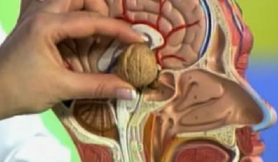 Светлана выписана из Склифа здоровой и несколько лет борьбы с болезнью  Светлана выписана из Склифа здоровой и несколько лет борьбы с болезнью