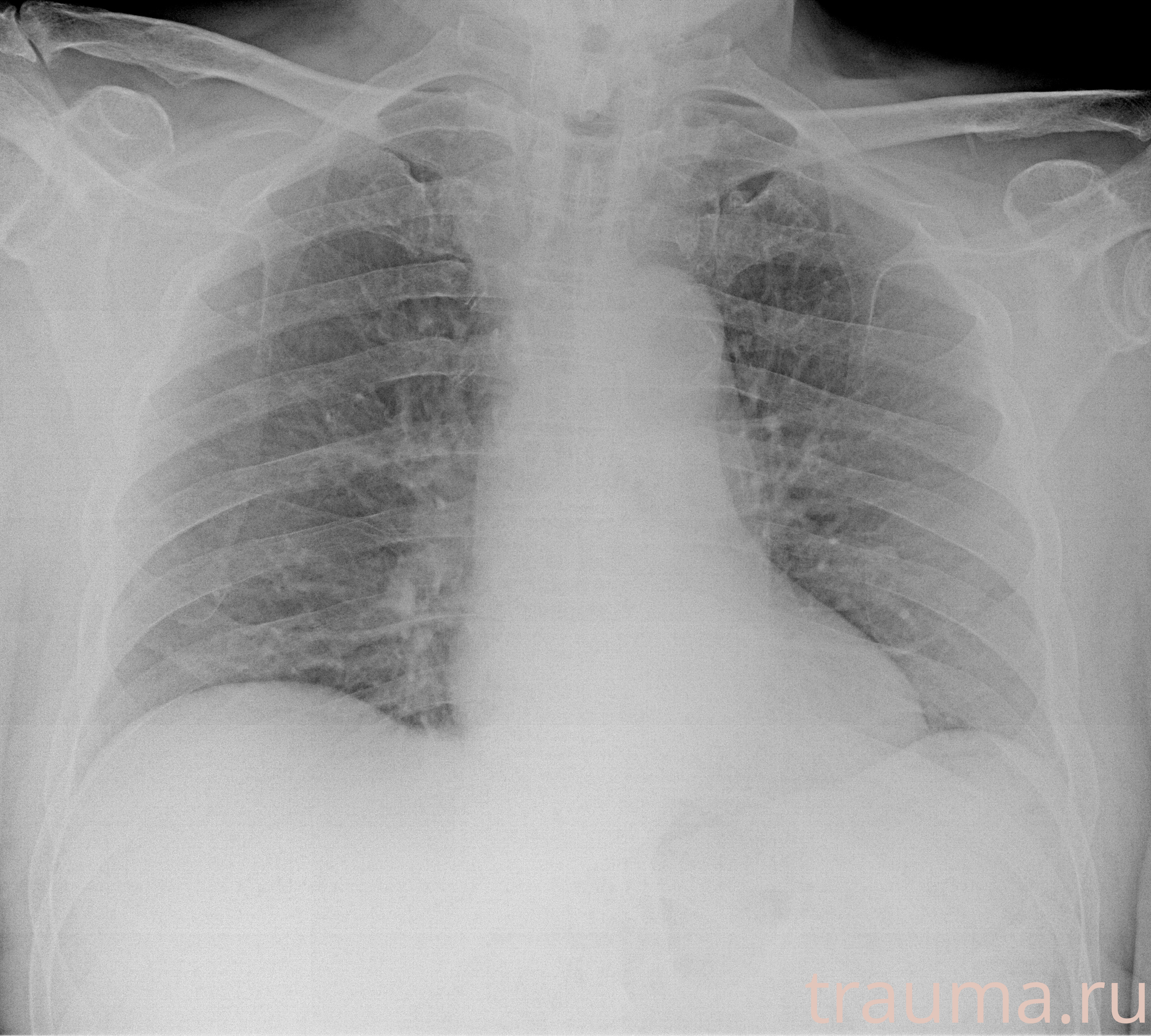 Рентген на дому: по вашему адресу приезжает врач-рентгенолог, травматолог-ортопед с мобильным рентгеновским аппаратом, проводит диагностику травмы или заболевания, делает необходимые рентгенограммы, дает рекомендации по дальнейшему лечению. Получить качественные снимки в домашних условиях возможно благодаря уникальной методике, разработанной МосРентген Центром для института  Склифосовского